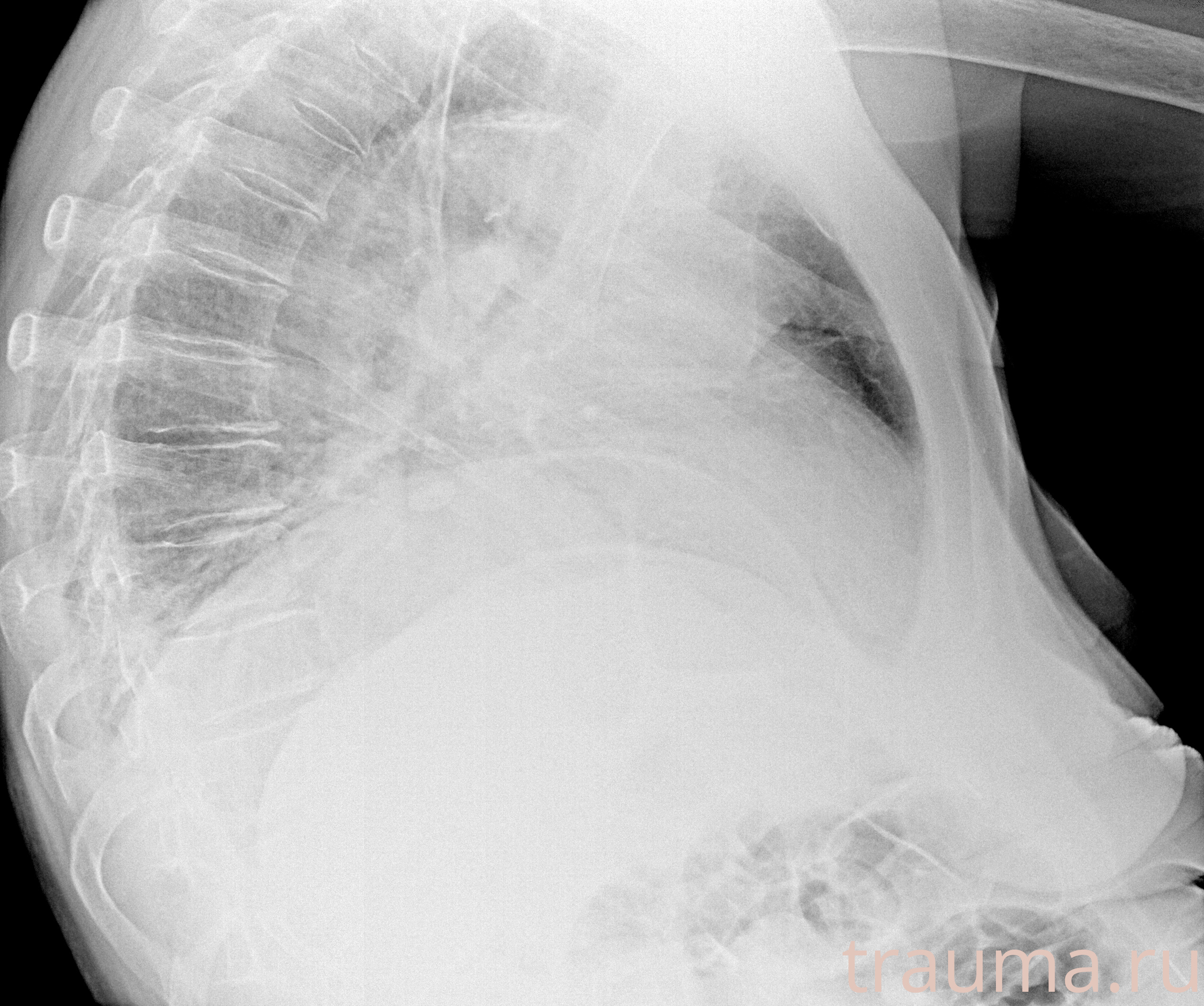 Рентген на дому: по вашему адресу приезжает врач-рентгенолог, травматолог-ортопед с мобильным рентгеновским аппаратом, проводит диагностику травмы или заболевания, делает необходимые рентгенограммы, дает рекомендации по дальнейшему лечению. Получить качественные снимки в домашних условиях возможно благодаря уникальной методике, разработанной МосРентген Центром для института  Склифосовского