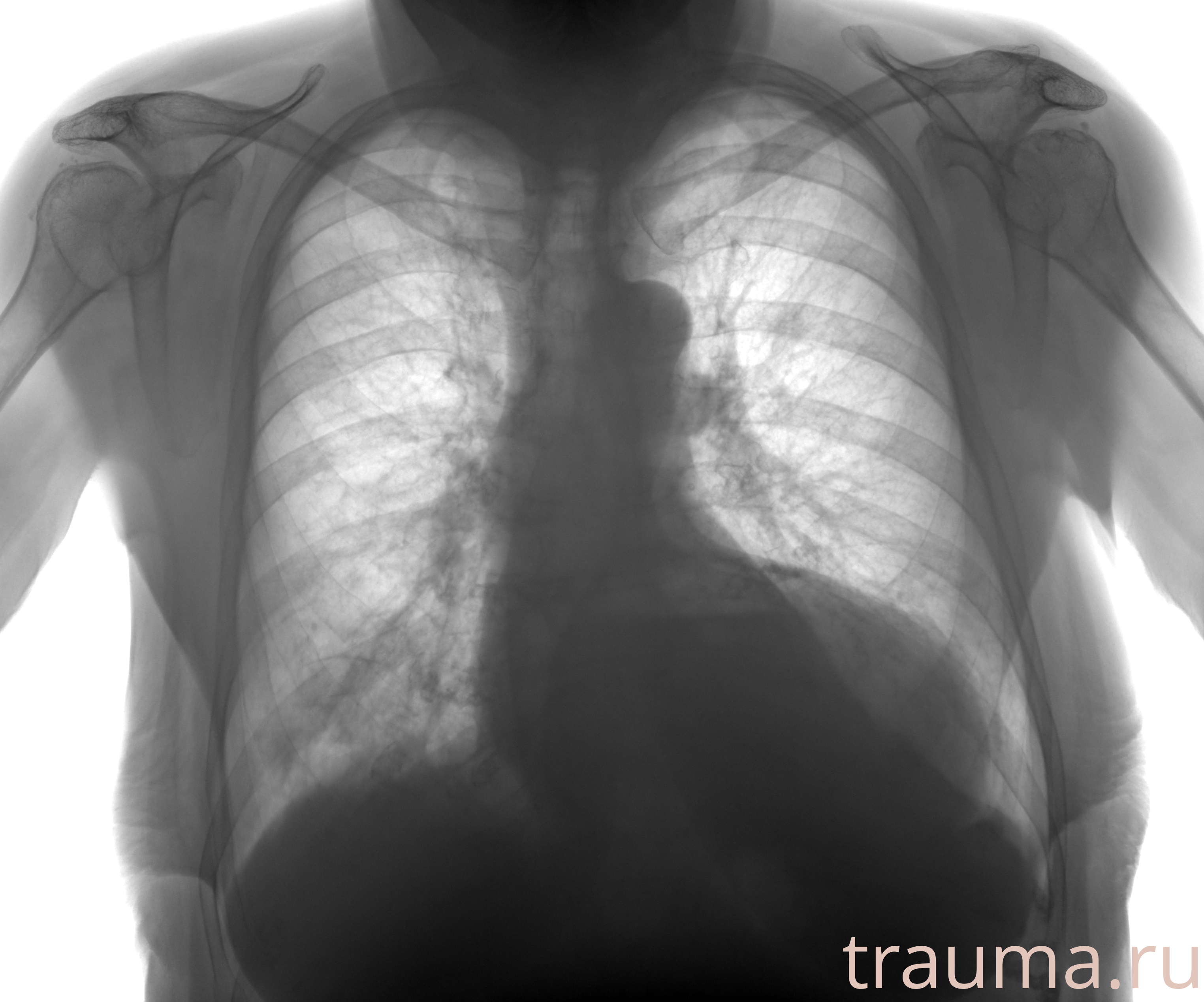 Рентген на дому: по вашему адресу приезжает врач-рентгенолог, травматолог-ортопед с мобильным рентгеновским аппаратом, проводит диагностику травмы или заболевания, делает необходимые рентгенограммы, дает рекомендации по дальнейшему лечению. Получить качественные снимки в домашних условиях возможно благодаря уникальной методике, разработанной МосРентген Центром для института  Склифосовского