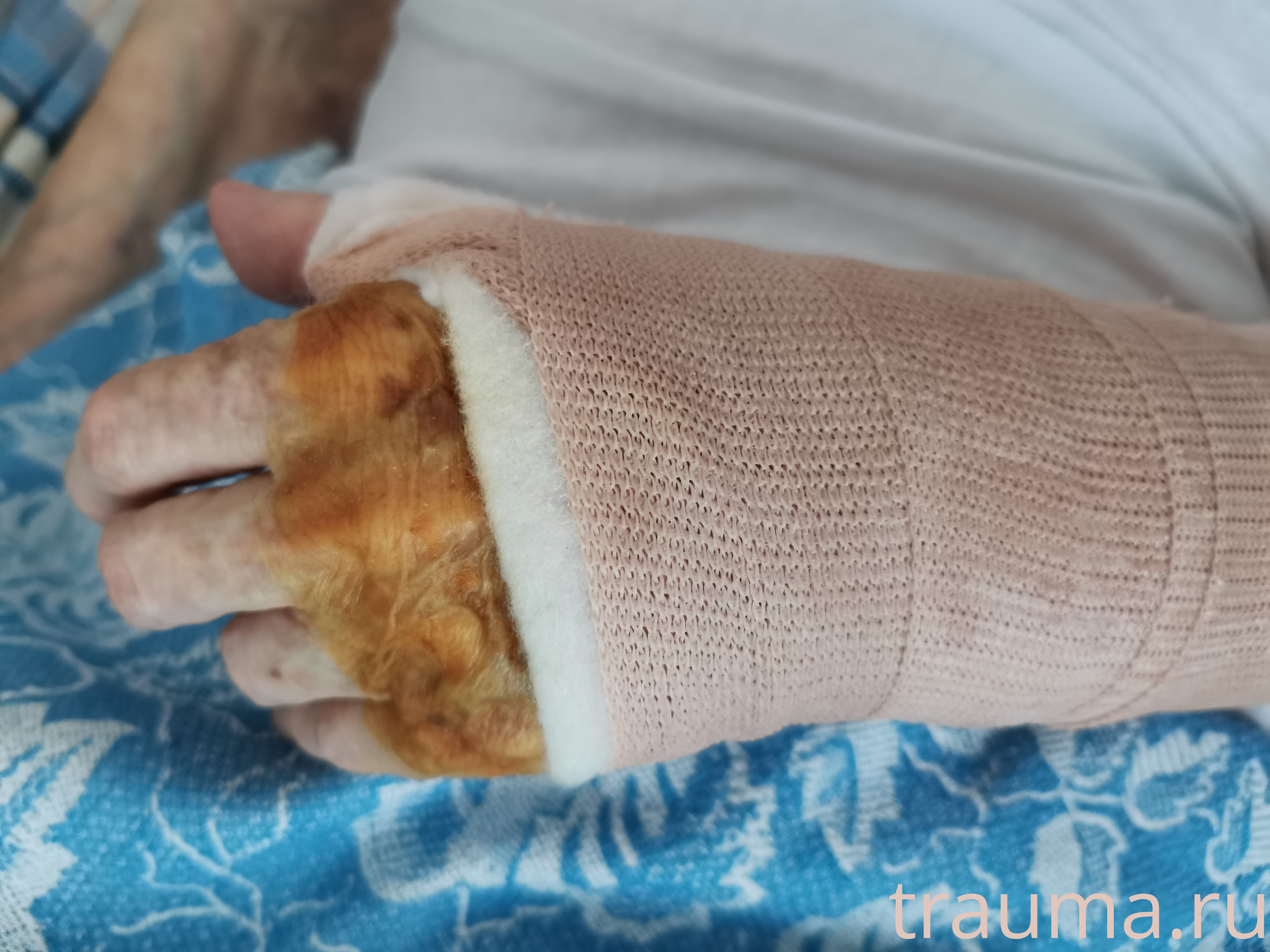 Рентген на дому: по вашему адресу приезжает врач-рентгенолог, травматолог-ортопед с мобильным рентгеновским аппаратом, проводит диагностику травмы или заболевания, делает необходимые рентгенограммы, дает рекомендации по дальнейшему лечению. Получить качественные снимки в домашних условиях возможно благодаря уникальной методике, разработанной МосРентген Центром для института  Склифосовского