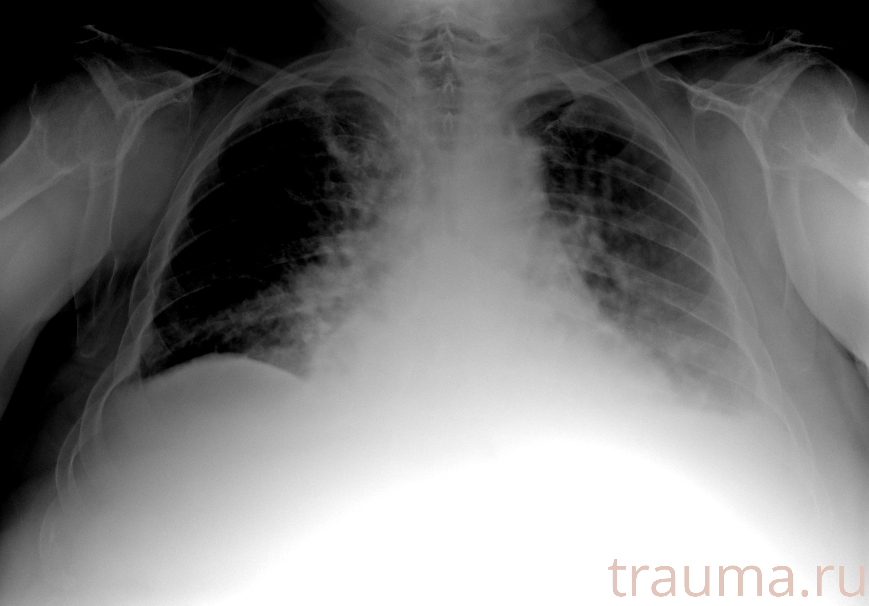 Рентген на дому: по вашему адресу приезжает врач-рентгенолог, травматолог-ортопед с мобильным рентгеновским аппаратом, проводит диагностику травмы или заболевания, делает необходимые рентгенограммы, дает рекомендации по дальнейшему лечению. Получить качественные снимки в домашних условиях возможно благодаря уникальной методике, разработанной МосРентген Центром для института  Склифосовского