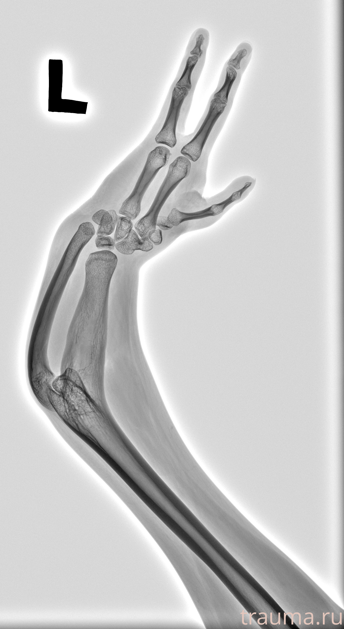 Рентген на дому: по вашему адресу приезжает врач-рентгенолог, травматолог-ортопед с мобильным рентгеновским аппаратом, проводит диагностику травмы или заболевания, делает необходимые рентгенограммы, дает рекомендации по дальнейшему лечению. Получить качественные снимки в домашних условиях возможно благодаря уникальной методике, разработанной МосРентген Центром для института  Склифосовского