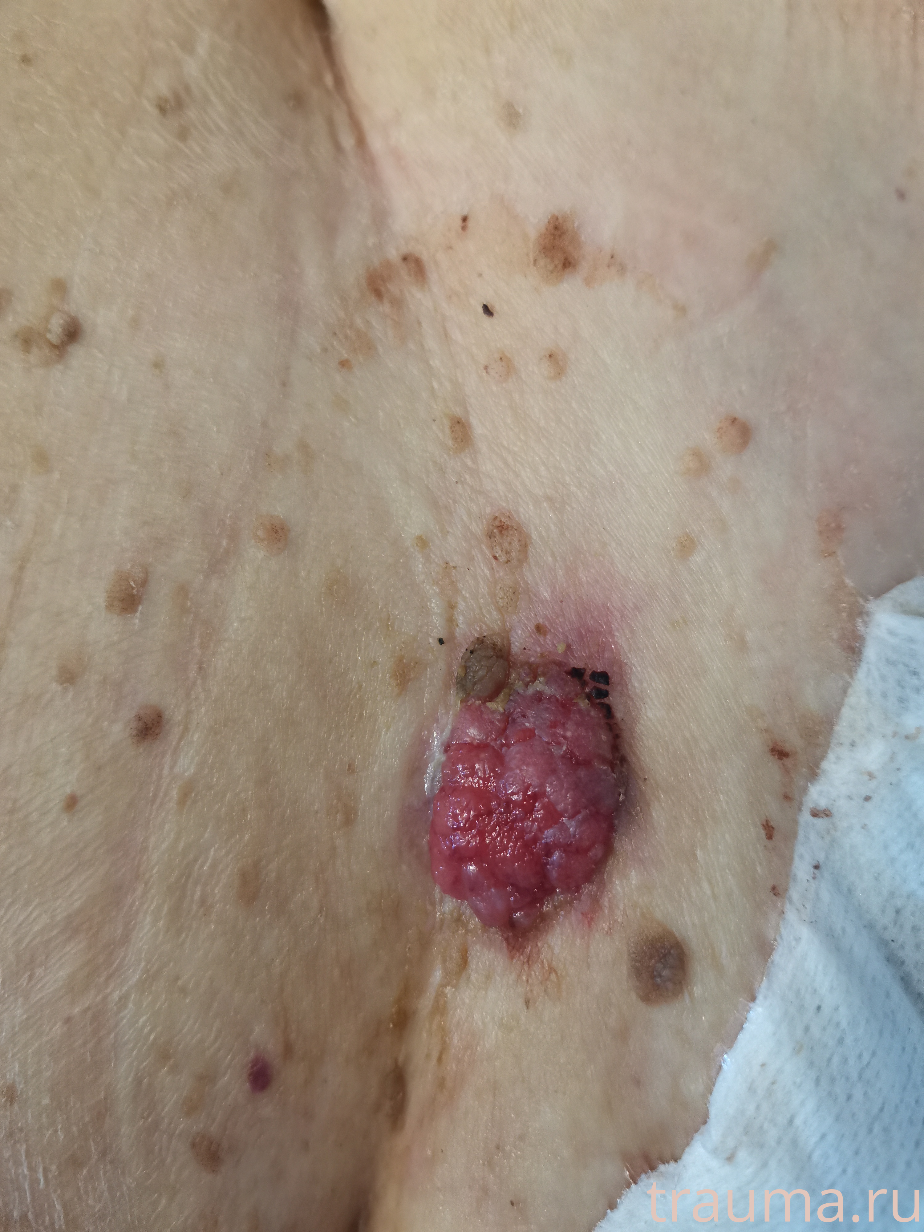 Рентген на дому: по вашему адресу приезжает врач-рентгенолог, травматолог-ортопед с мобильным рентгеновским аппаратом, проводит диагностику травмы или заболевания, делает необходимые рентгенограммы, дает рекомендации по дальнейшему лечению. Получить качественные снимки в домашних условиях возможно благодаря уникальной методике, разработанной МосРентген Центром для института  Склифосовского