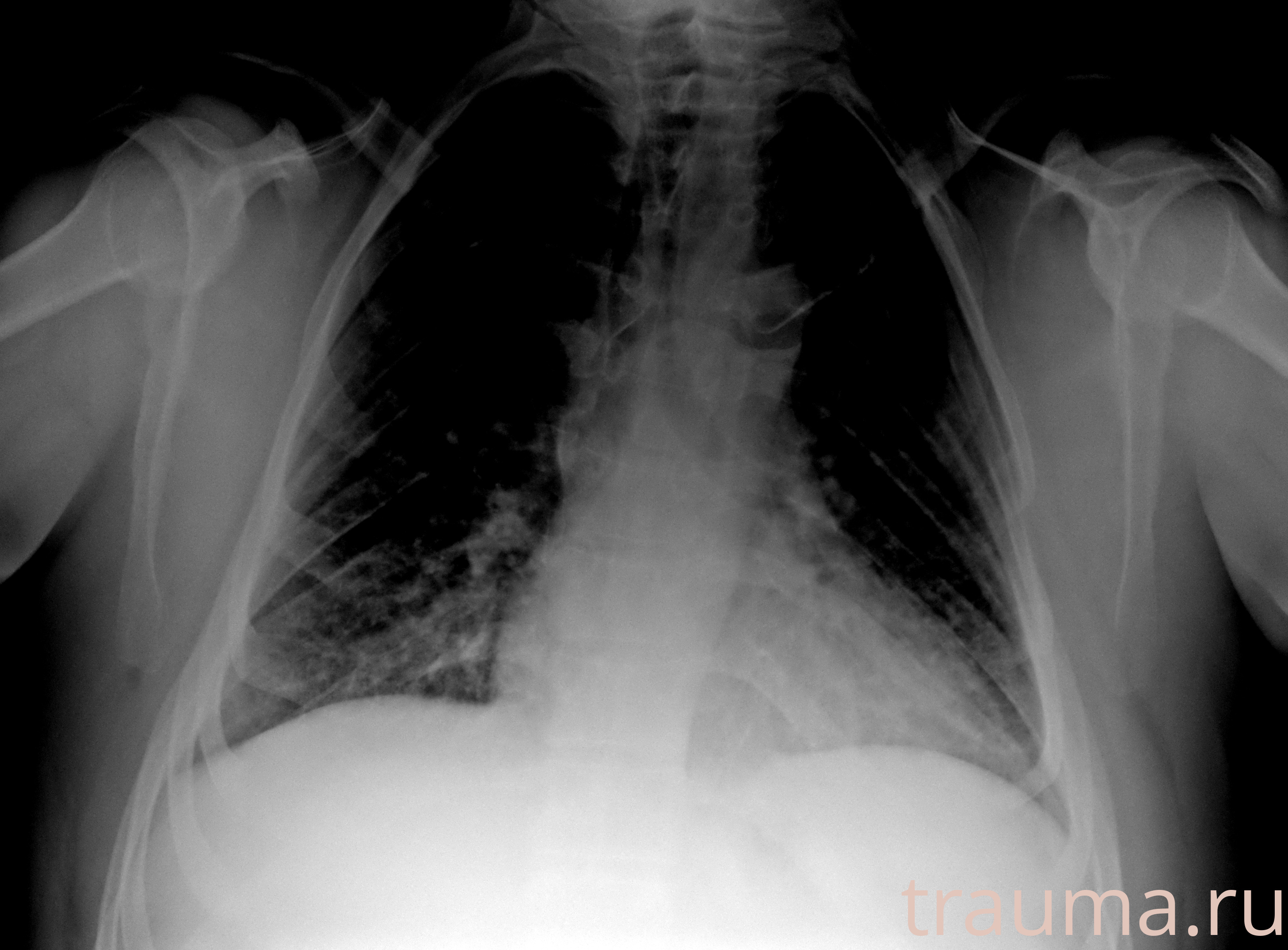 Рентген на дому: по вашему адресу приезжает врач-рентгенолог, травматолог-ортопед с мобильным рентгеновским аппаратом, проводит диагностику травмы или заболевания, делает необходимые рентгенограммы, дает рекомендации по дальнейшему лечению. Получить качественные снимки в домашних условиях возможно благодаря уникальной методике, разработанной МосРентген Центром для института  Склифосовского