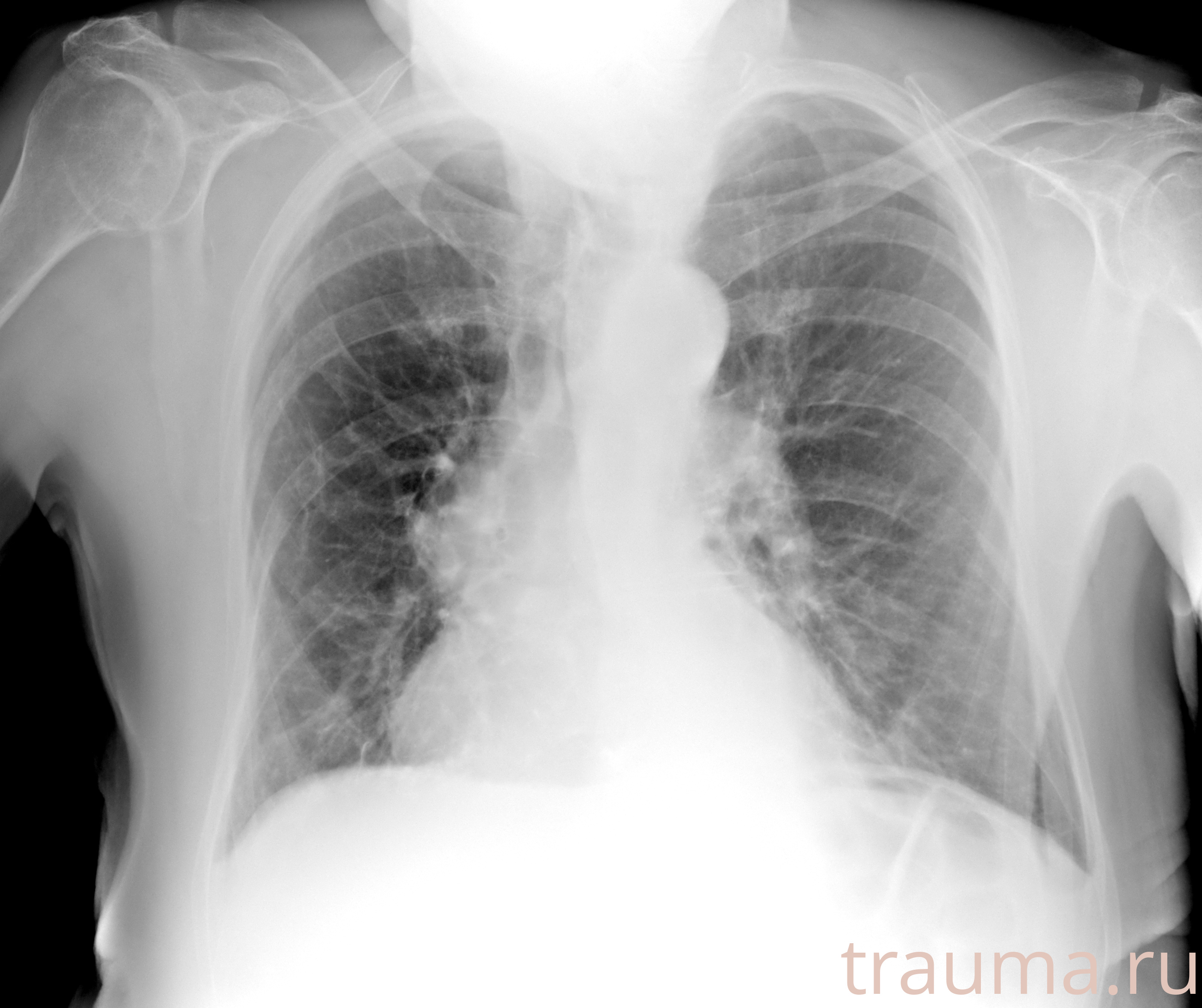 Рентген на дому: по вашему адресу приезжает врач-рентгенолог, травматолог-ортопед с мобильным рентгеновским аппаратом, проводит диагностику травмы или заболевания, делает необходимые рентгенограммы, дает рекомендации по дальнейшему лечению. Получить качественные снимки в домашних условиях возможно благодаря уникальной методике, разработанной МосРентген Центром для института  Склифосовского