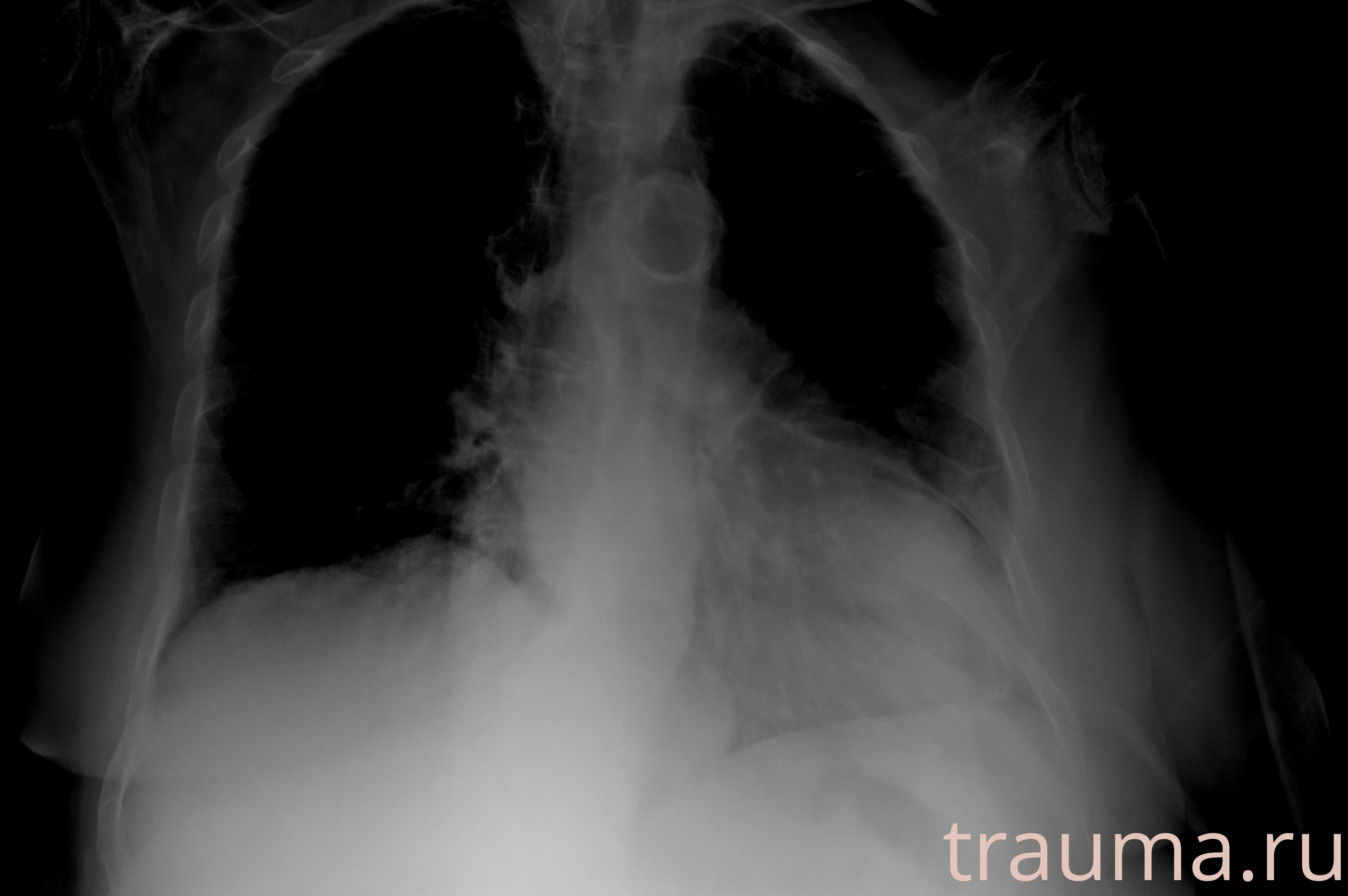 Рентген на дому: по вашему адресу приезжает врач-рентгенолог, травматолог-ортопед с мобильным рентгеновским аппаратом, проводит диагностику травмы или заболевания, делает необходимые рентгенограммы, дает рекомендации по дальнейшему лечению. Получить качественные снимки в домашних условиях возможно благодаря уникальной методике, разработанной МосРентген Центром для института  Склифосовского