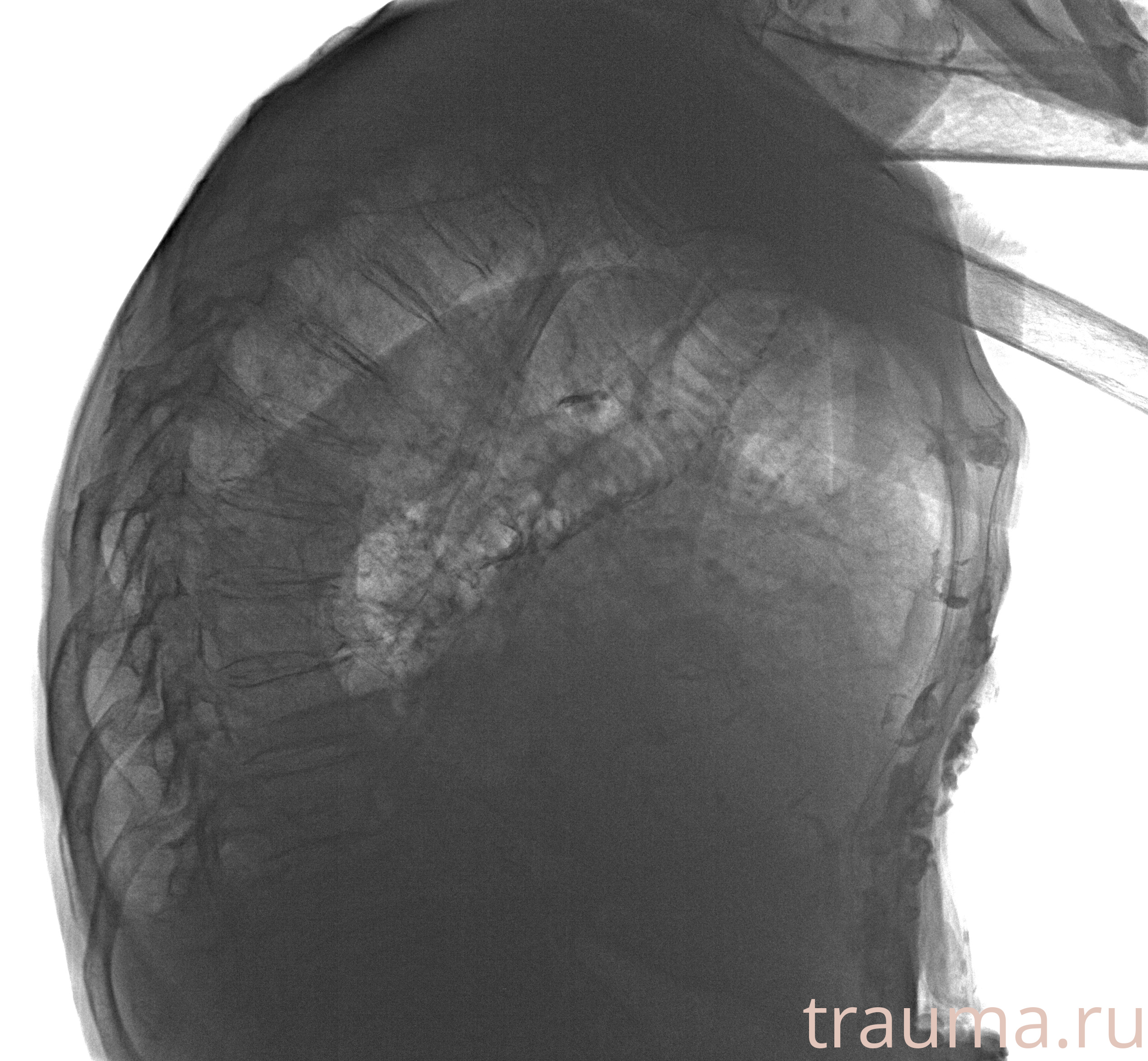 Рентген на дому: по вашему адресу приезжает врач-рентгенолог, травматолог-ортопед с мобильным рентгеновским аппаратом, проводит диагностику травмы или заболевания, делает необходимые рентгенограммы, дает рекомендации по дальнейшему лечению. Получить качественные снимки в домашних условиях возможно благодаря уникальной методике, разработанной МосРентген Центром для института  Склифосовского