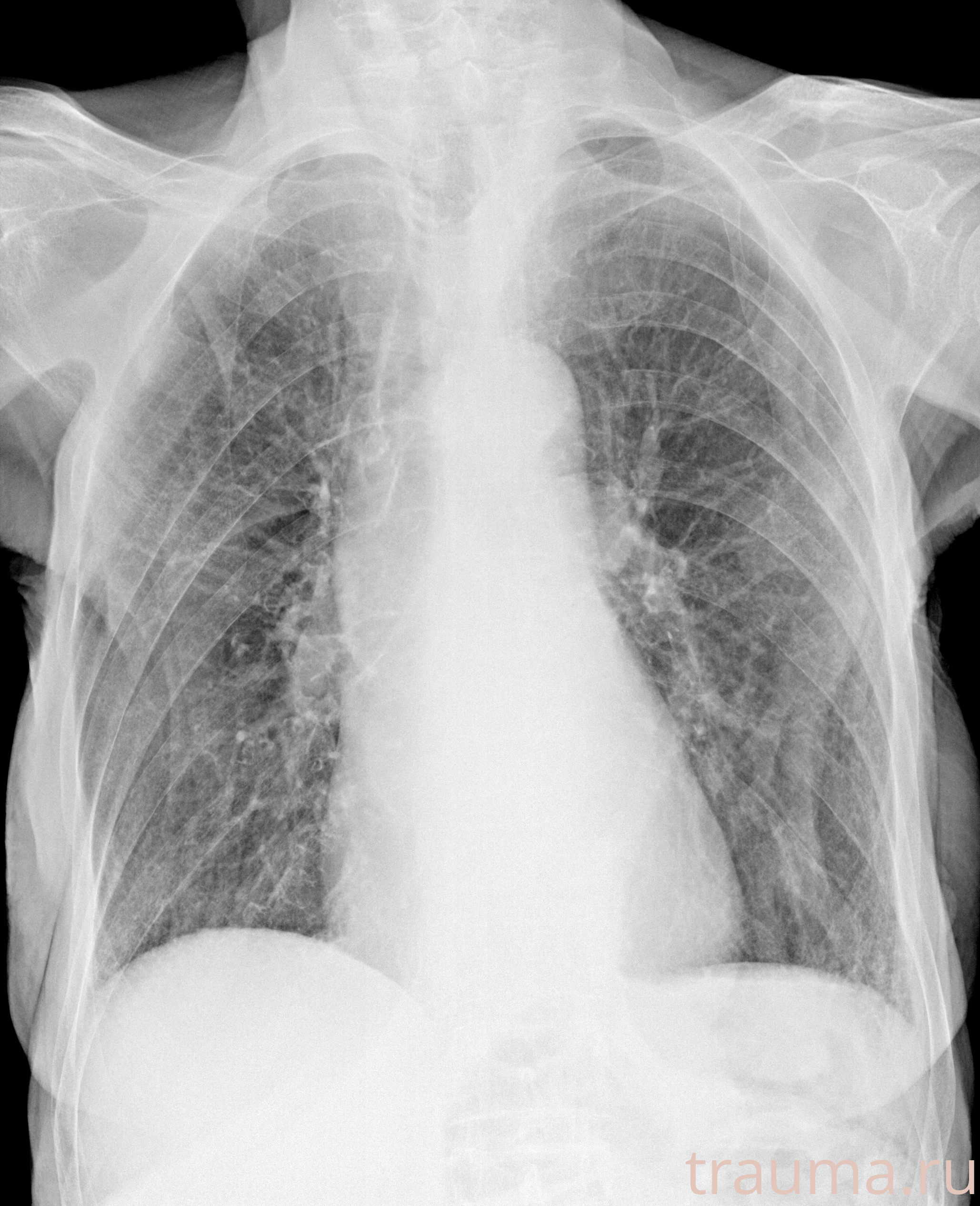 Рентген на дому: по вашему адресу приезжает врач-рентгенолог, травматолог-ортопед с мобильным рентгеновским аппаратом, проводит диагностику травмы или заболевания, делает необходимые рентгенограммы, дает рекомендации по дальнейшему лечению. Получить качественные снимки в домашних условиях возможно благодаря уникальной методике, разработанной МосРентген Центром для института  Склифосовского