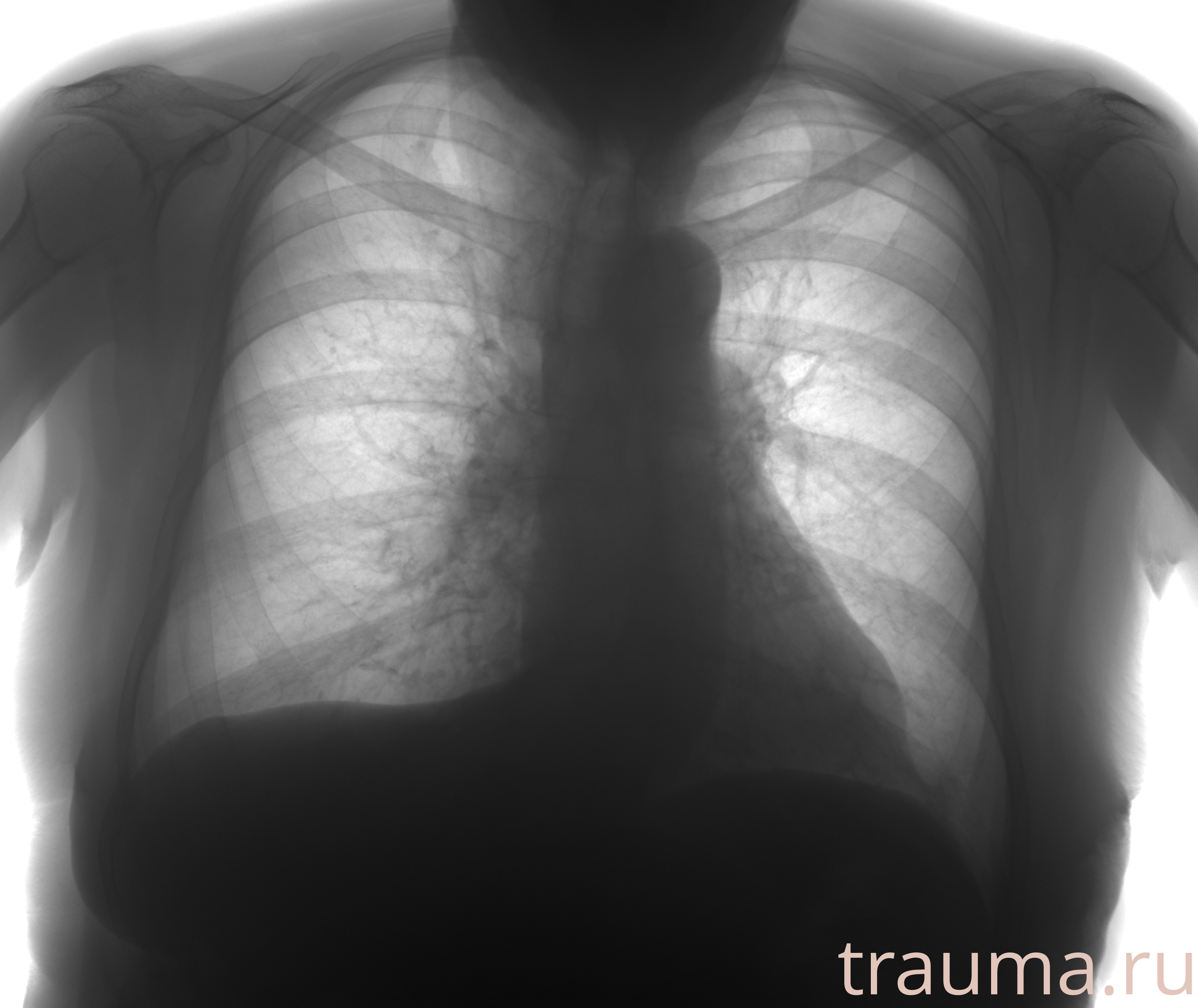 Рентген на дому: по вашему адресу приезжает врач-рентгенолог, травматолог-ортопед с мобильным рентгеновским аппаратом, проводит диагностику травмы или заболевания, делает необходимые рентгенограммы, дает рекомендации по дальнейшему лечению. Получить качественные снимки в домашних условиях возможно благодаря уникальной методике, разработанной МосРентген Центром для института  Склифосовского