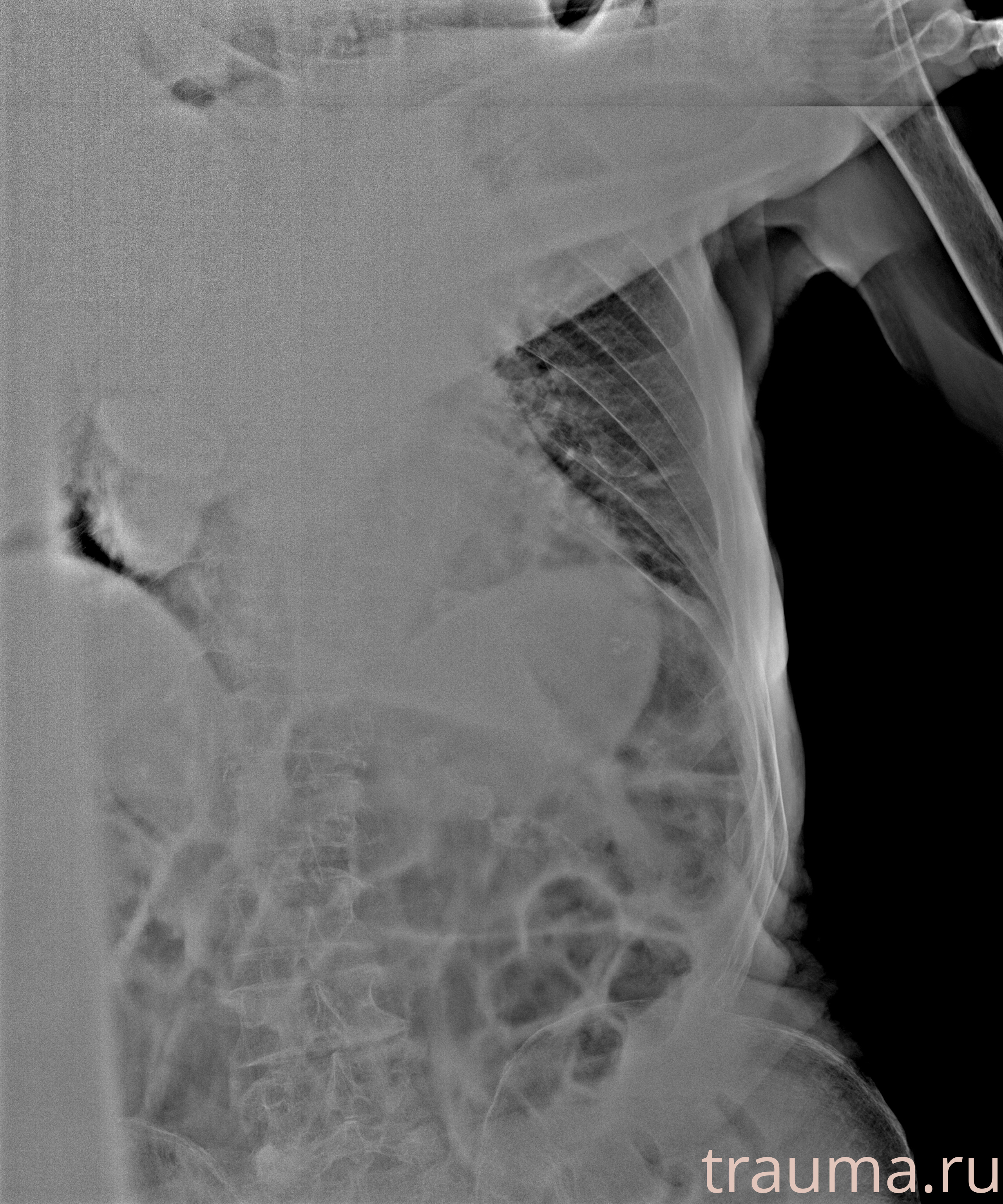 Рентген на дому: по вашему адресу приезжает врач-рентгенолог, травматолог-ортопед с мобильным рентгеновским аппаратом, проводит диагностику травмы или заболевания, делает необходимые рентгенограммы, дает рекомендации по дальнейшему лечению. Получить качественные снимки в домашних условиях возможно благодаря уникальной методике, разработанной МосРентген Центром для института  Склифосовского