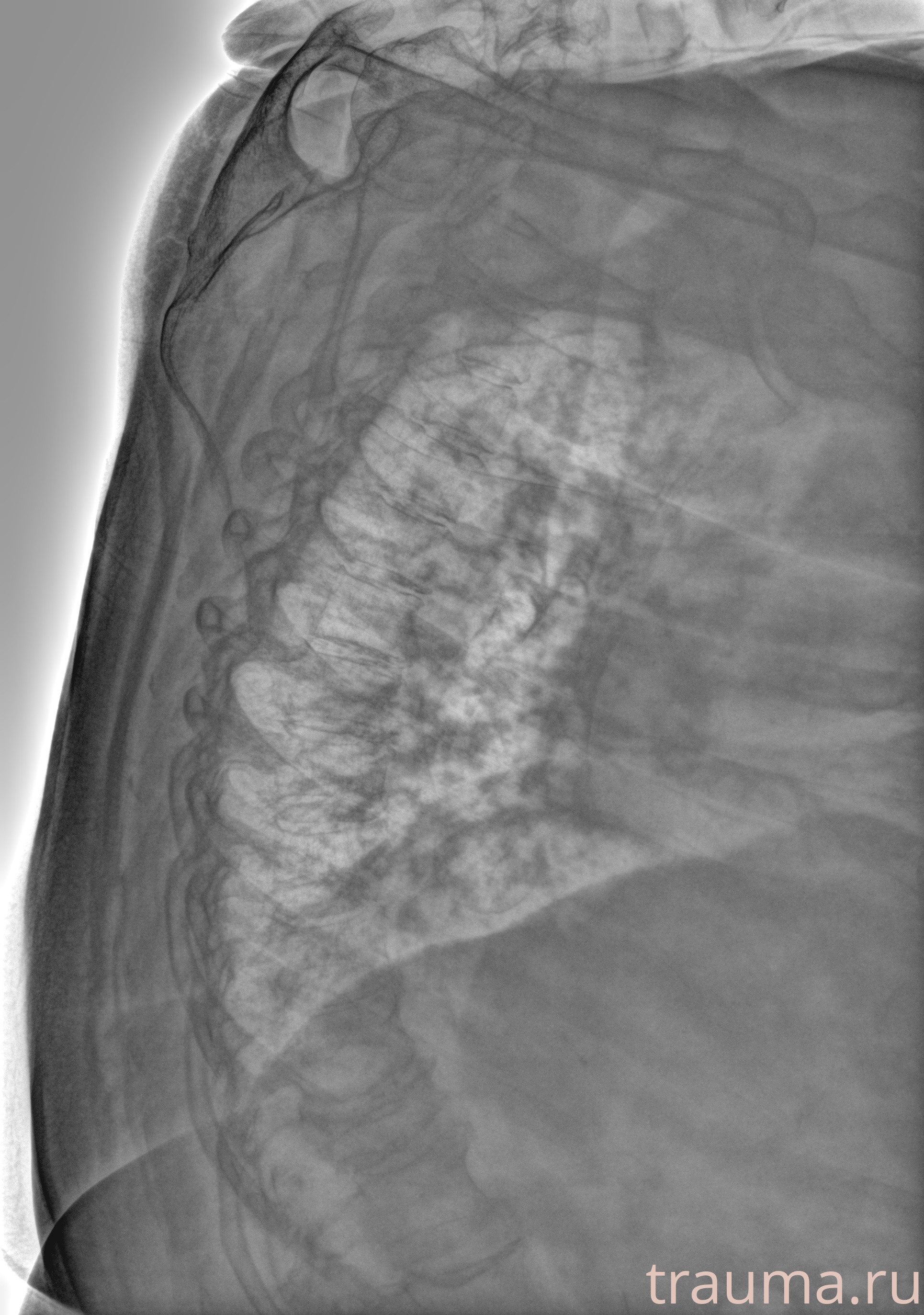 Рентген на дому: по вашему адресу приезжает врач-рентгенолог, травматолог-ортопед с мобильным рентгеновским аппаратом, проводит диагностику травмы или заболевания, делает необходимые рентгенограммы, дает рекомендации по дальнейшему лечению. Получить качественные снимки в домашних условиях возможно благодаря уникальной методике, разработанной МосРентген Центром для института  Склифосовского