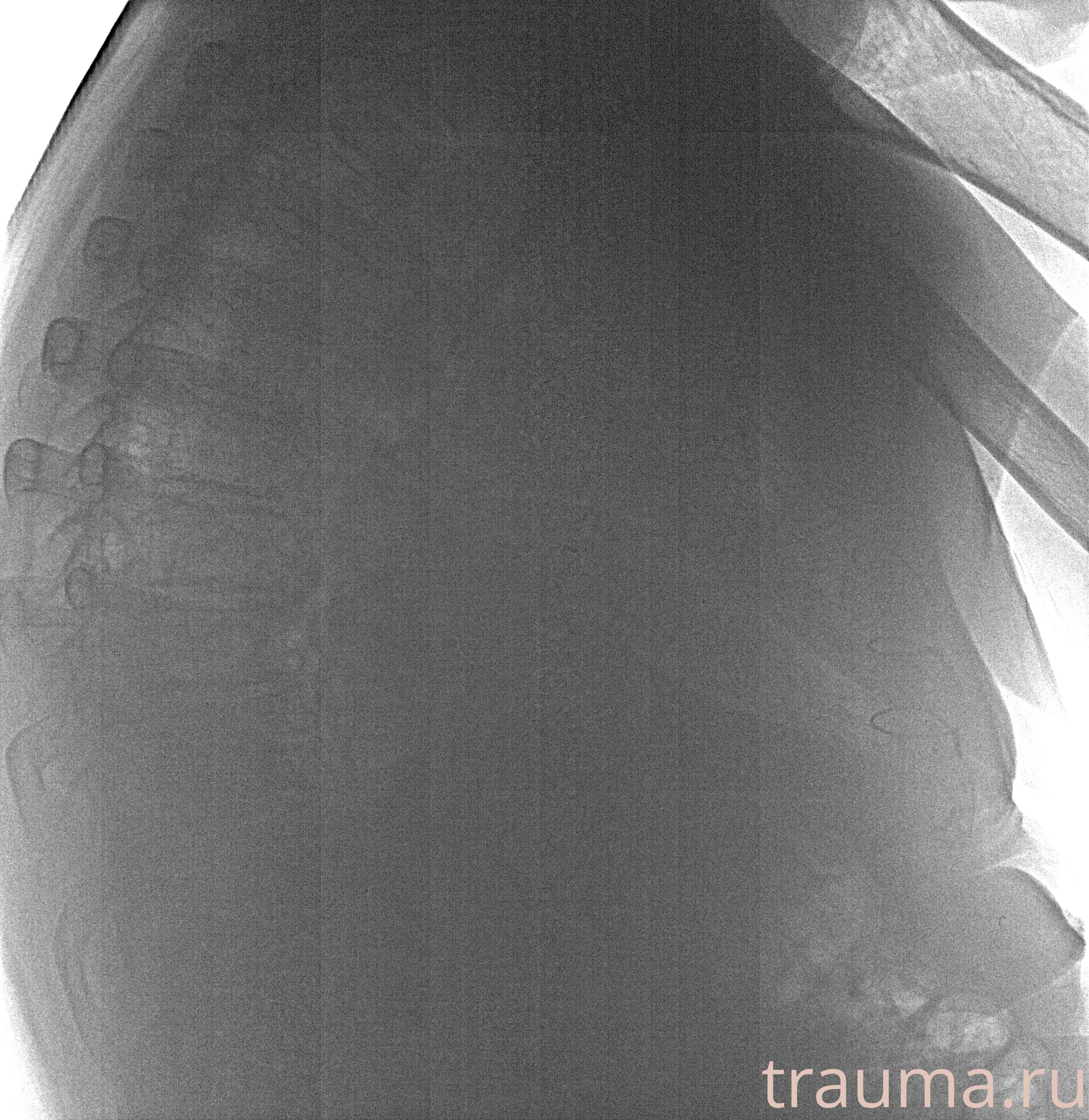 Рентген на дому: по вашему адресу приезжает врач-рентгенолог, травматолог-ортопед с мобильным рентгеновским аппаратом, проводит диагностику травмы или заболевания, делает необходимые рентгенограммы, дает рекомендации по дальнейшему лечению. Получить качественные снимки в домашних условиях возможно благодаря уникальной методике, разработанной МосРентген Центром для института  Склифосовского