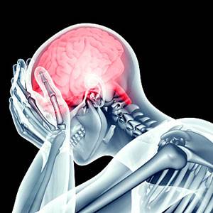 Что такое деменция? Что такое деменция?