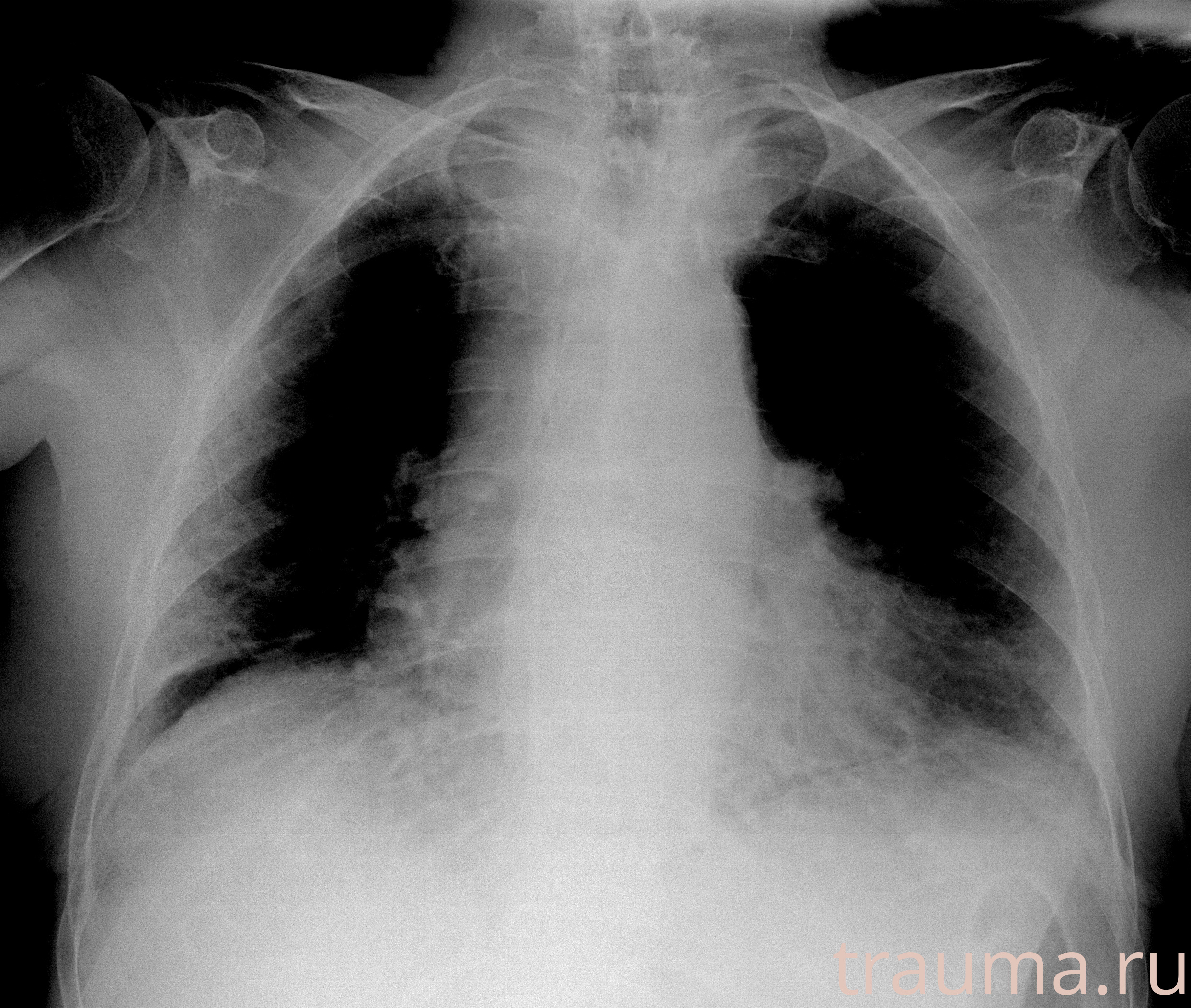 Рентген на дому: по вашему адресу приезжает врач-рентгенолог, травматолог-ортопед с мобильным рентгеновским аппаратом, проводит диагностику травмы или заболевания, делает необходимые рентгенограммы, дает рекомендации по дальнейшему лечению. Получить качественные снимки в домашних условиях возможно благодаря уникальной методике, разработанной МосРентген Центром для института  Склифосовского