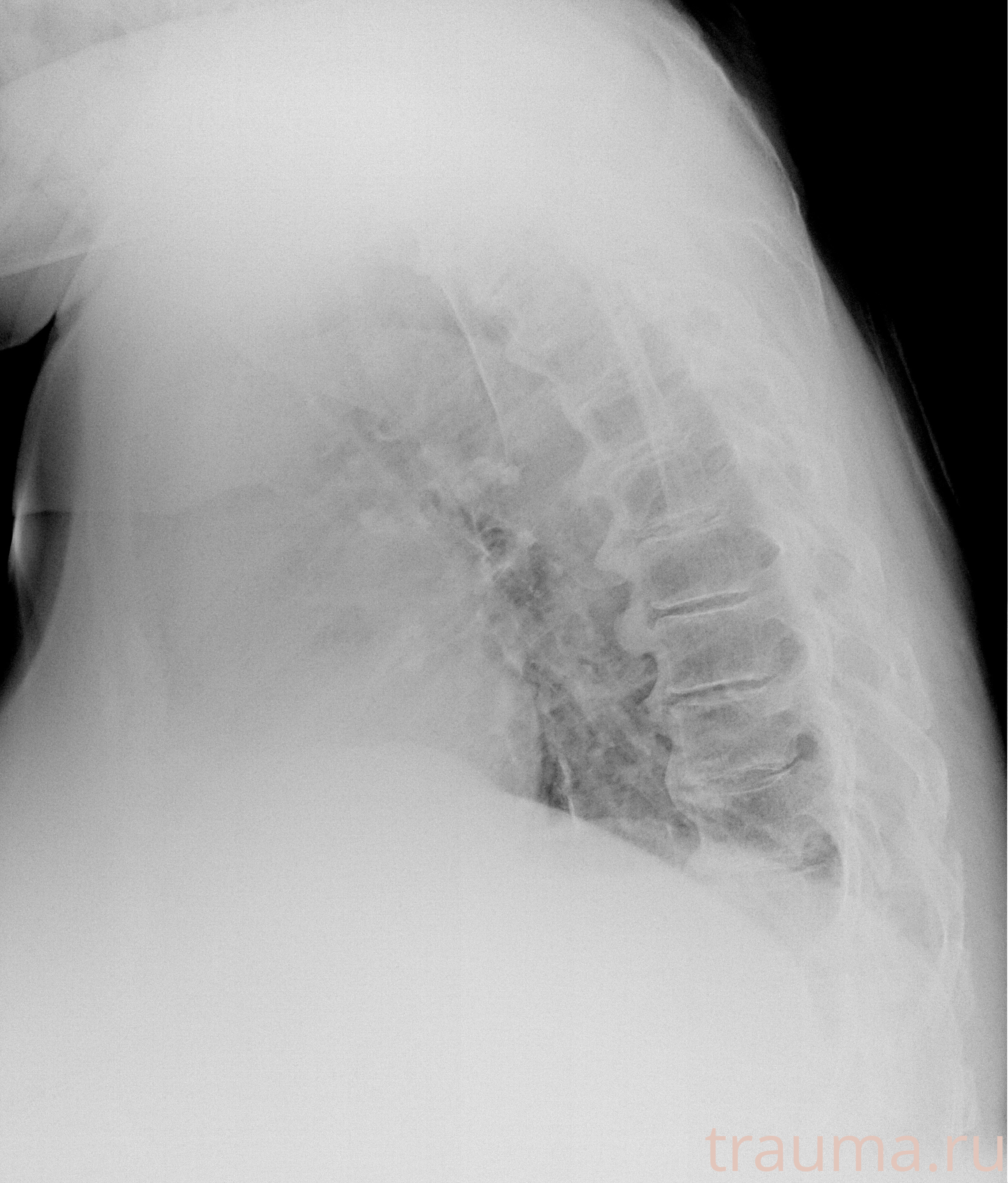 Рентген на дому: по вашему адресу приезжает врач-рентгенолог, травматолог-ортопед с мобильным рентгеновским аппаратом, проводит диагностику травмы или заболевания, делает необходимые рентгенограммы, дает рекомендации по дальнейшему лечению. Получить качественные снимки в домашних условиях возможно благодаря уникальной методике, разработанной МосРентген Центром для института  Склифосовского