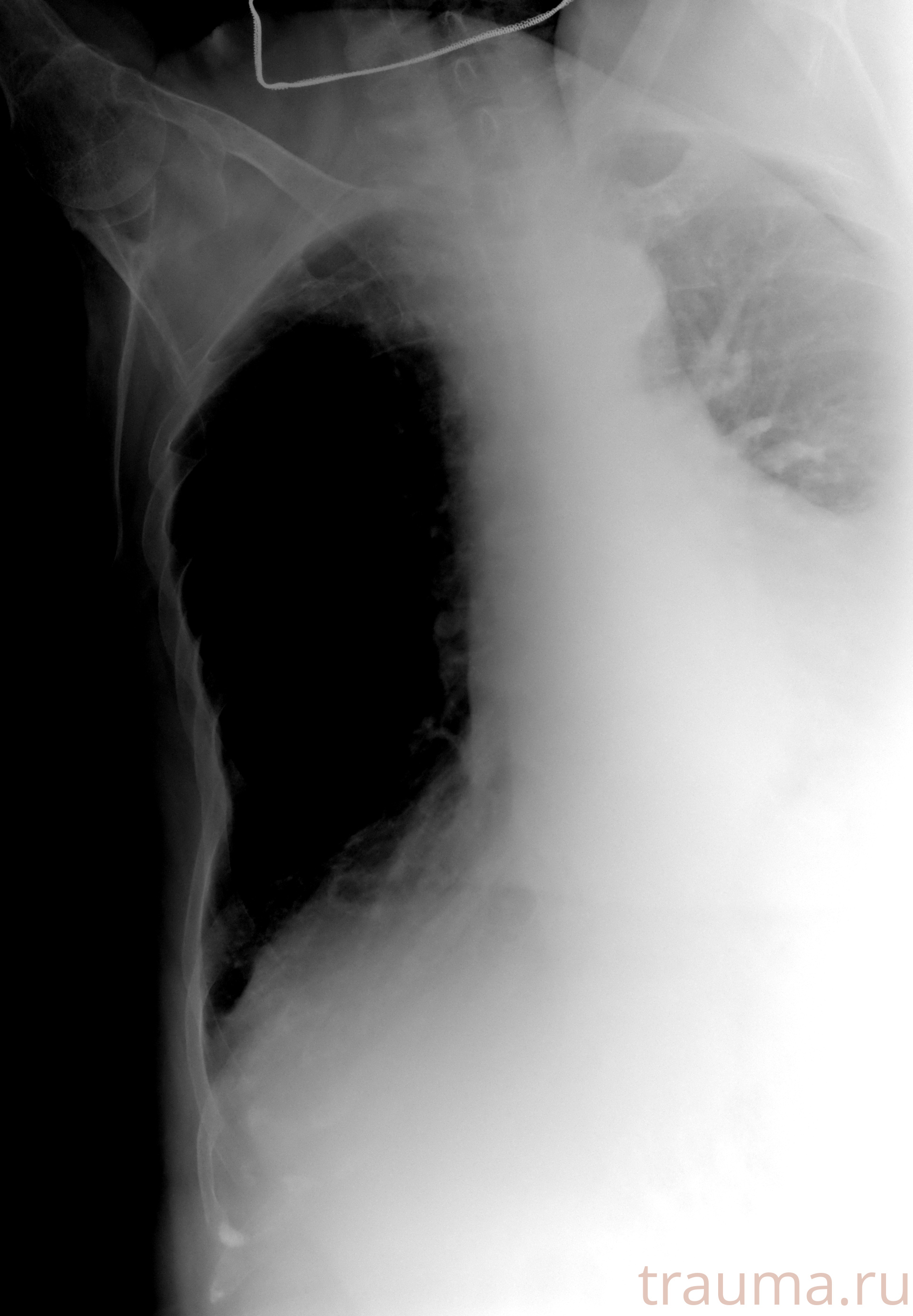 Рентген на дому: по вашему адресу приезжает врач-рентгенолог, травматолог-ортопед с мобильным рентгеновским аппаратом, проводит диагностику травмы или заболевания, делает необходимые рентгенограммы, дает рекомендации по дальнейшему лечению. Получить качественные снимки в домашних условиях возможно благодаря уникальной методике, разработанной МосРентген Центром для института  Склифосовского