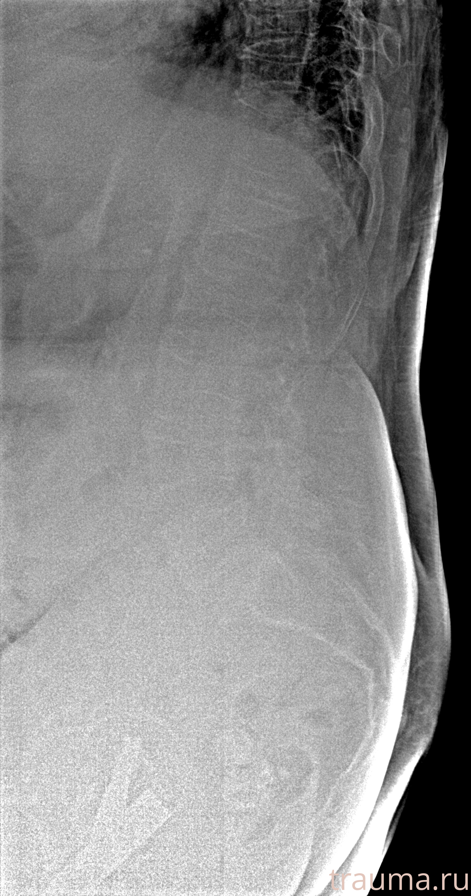Рентген на дому: по вашему адресу приезжает врач-рентгенолог, травматолог-ортопед с мобильным рентгеновским аппаратом, проводит диагностику травмы или заболевания, делает необходимые рентгенограммы, дает рекомендации по дальнейшему лечению. Получить качественные снимки в домашних условиях возможно благодаря уникальной методике, разработанной МосРентген Центром для института  Склифосовского
