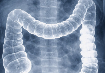 Популярное вещество для рентгена вернулось в нижегородские клиники