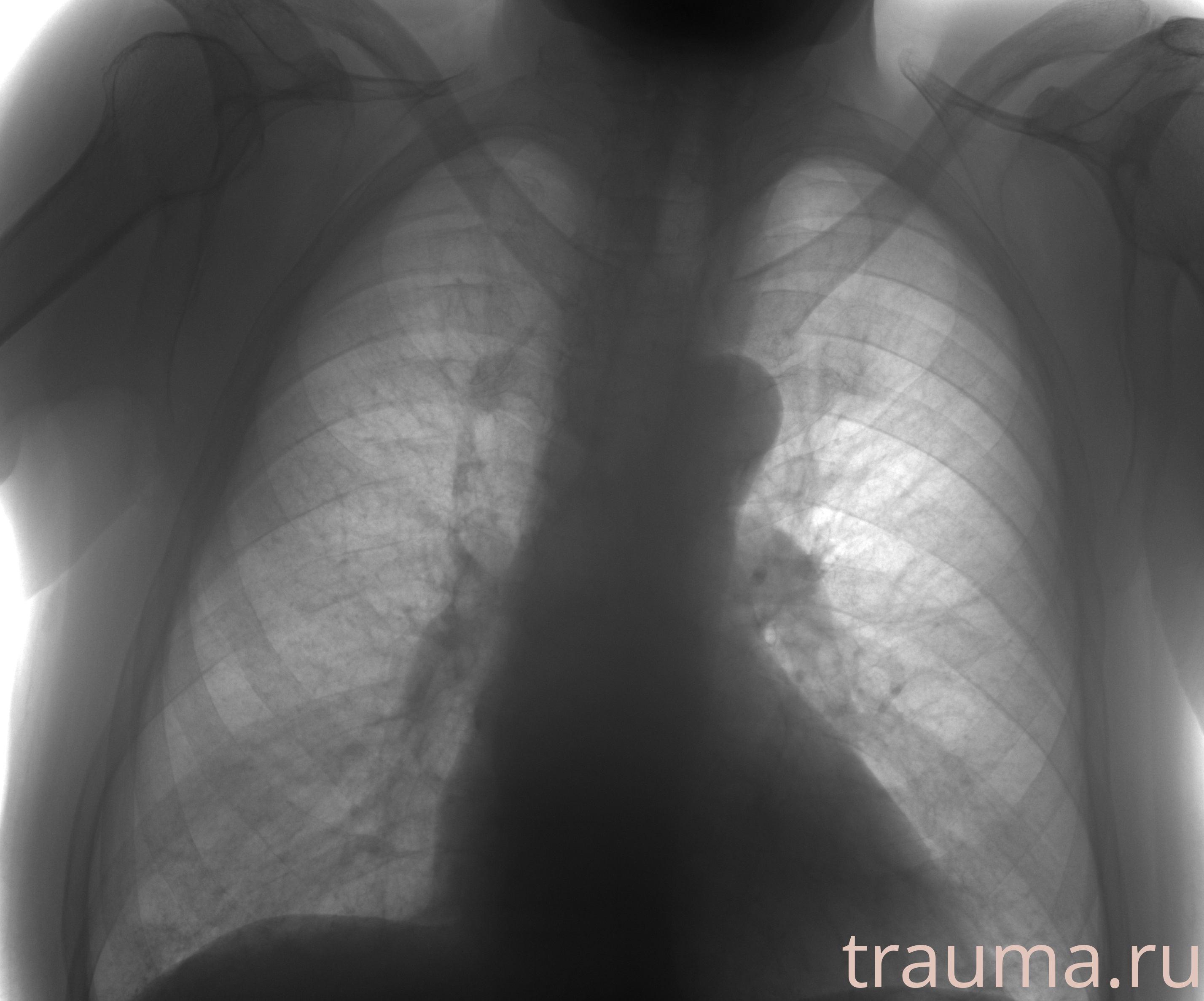 Рентген на дому: по вашему адресу приезжает врач-рентгенолог, травматолог-ортопед с мобильным рентгеновским аппаратом, проводит диагностику травмы или заболевания, делает необходимые рентгенограммы, дает рекомендации по дальнейшему лечению. Получить качественные снимки в домашних условиях возможно благодаря уникальной методике, разработанной МосРентген Центром для института  Склифосовского