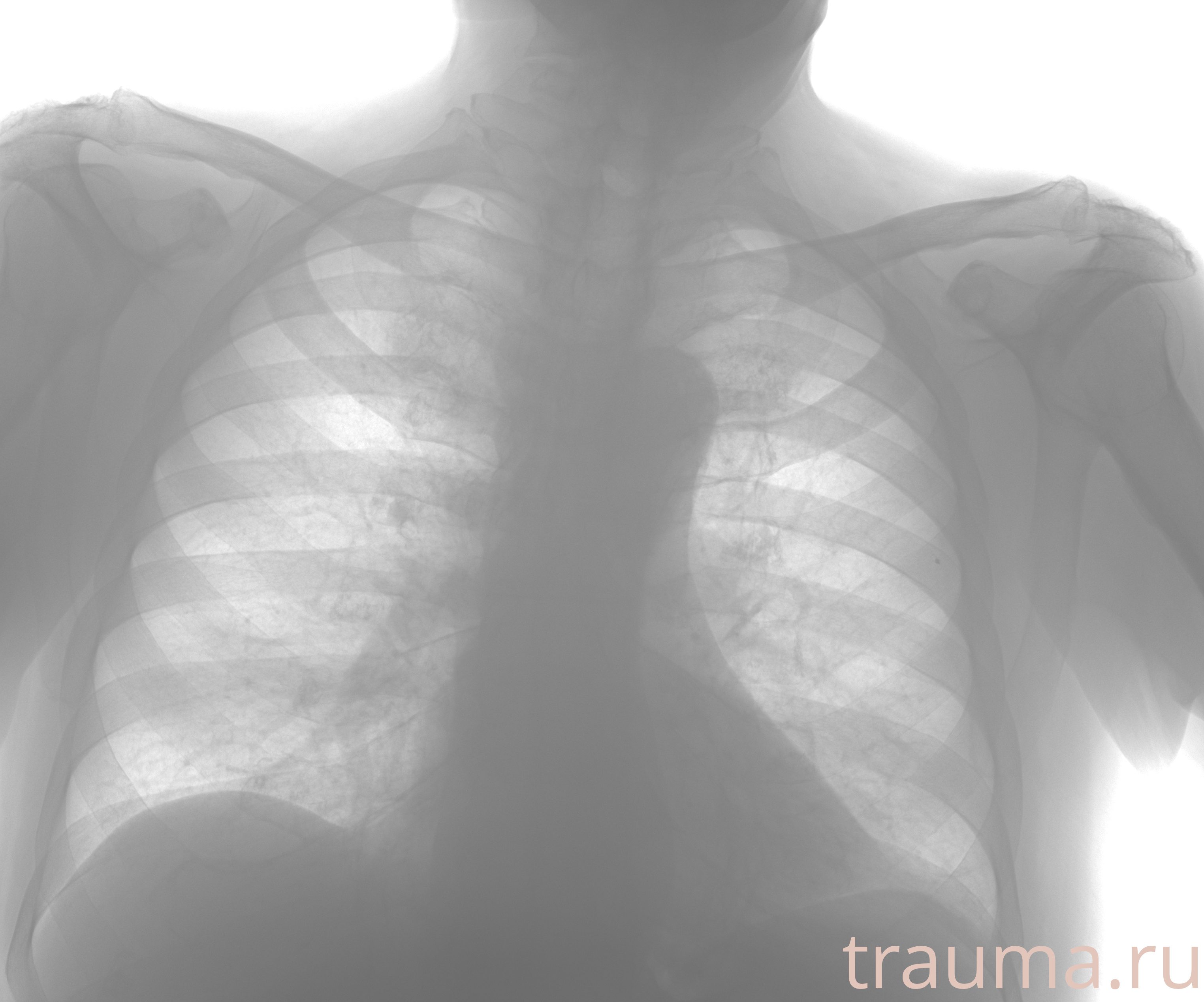 Рентген на дому: по вашему адресу приезжает врач-рентгенолог, травматолог-ортопед с мобильным рентгеновским аппаратом, проводит диагностику травмы или заболевания, делает необходимые рентгенограммы, дает рекомендации по дальнейшему лечению. Получить качественные снимки в домашних условиях возможно благодаря уникальной методике, разработанной МосРентген Центром для института  Склифосовского