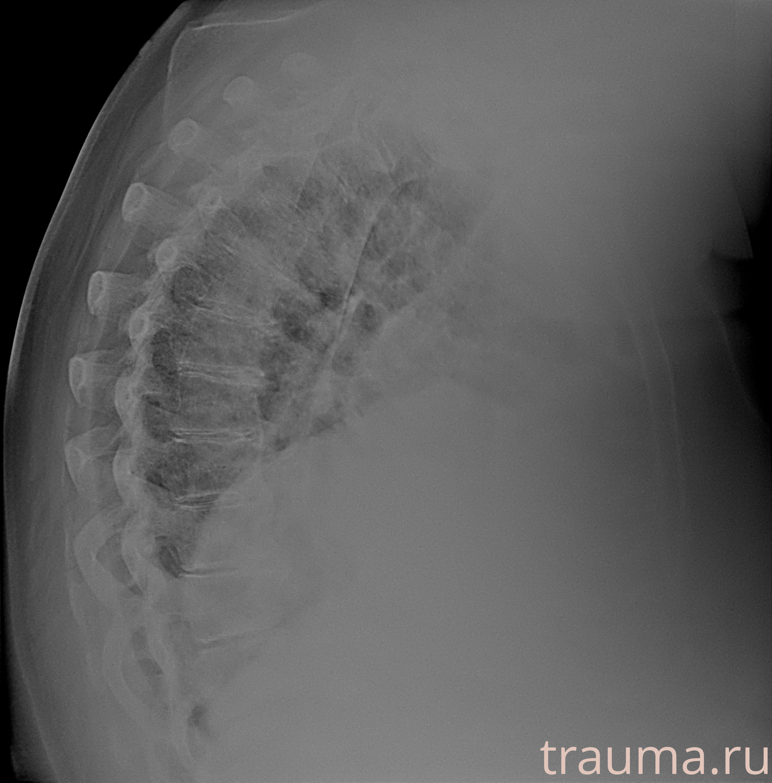 Рентген на дому: по вашему адресу приезжает врач-рентгенолог, травматолог-ортопед с мобильным рентгеновским аппаратом, проводит диагностику травмы или заболевания, делает необходимые рентгенограммы, дает рекомендации по дальнейшему лечению. Получить качественные снимки в домашних условиях возможно благодаря уникальной методике, разработанной МосРентген Центром для института  Склифосовского