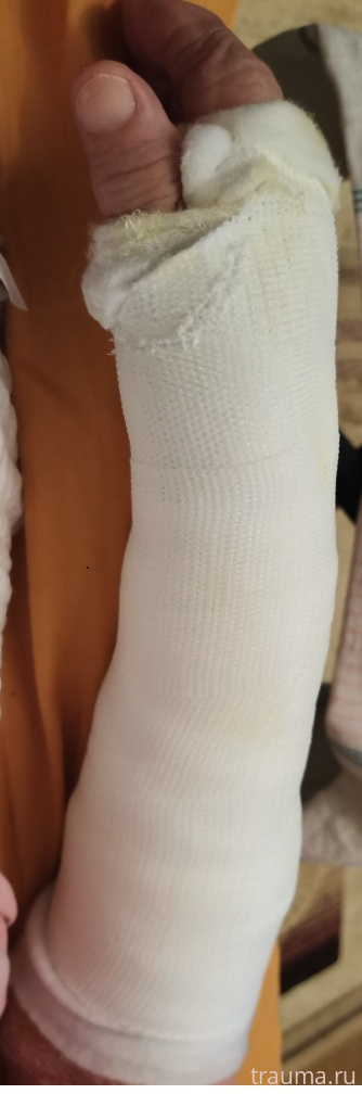 Рентген на дому: по вашему адресу приезжает врач-рентгенолог, травматолог-ортопед с мобильным рентгеновским аппаратом, проводит диагностику травмы или заболевания, делает необходимые рентгенограммы, дает рекомендации по дальнейшему лечению. Получить качественные снимки в домашних условиях возможно благодаря уникальной методике, разработанной МосРентген Центром для института  Склифосовского