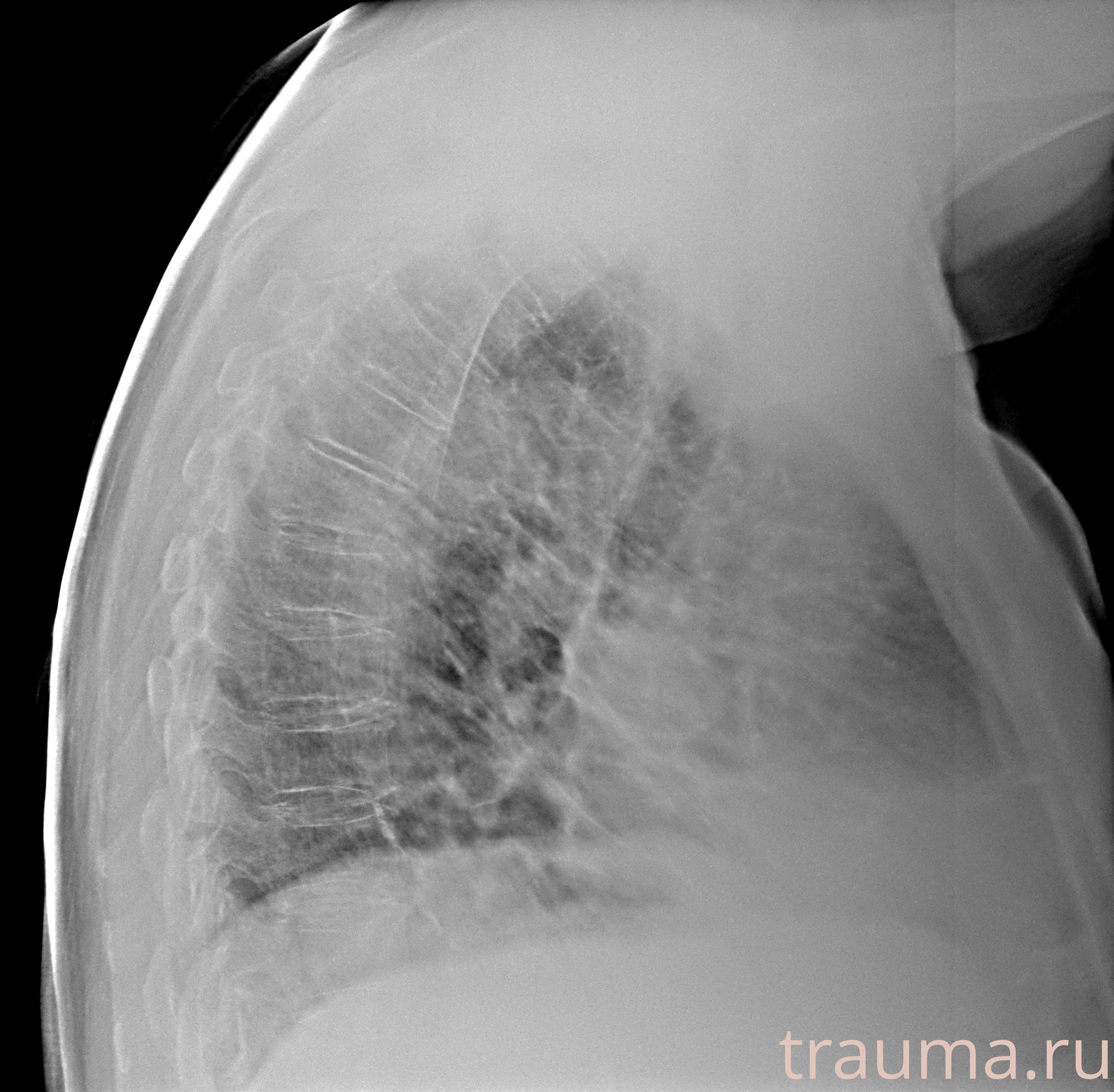 Рентген на дому: по вашему адресу приезжает врач-рентгенолог, травматолог-ортопед с мобильным рентгеновским аппаратом, проводит диагностику травмы или заболевания, делает необходимые рентгенограммы, дает рекомендации по дальнейшему лечению. Получить качественные снимки в домашних условиях возможно благодаря уникальной методике, разработанной МосРентген Центром для института  Склифосовского