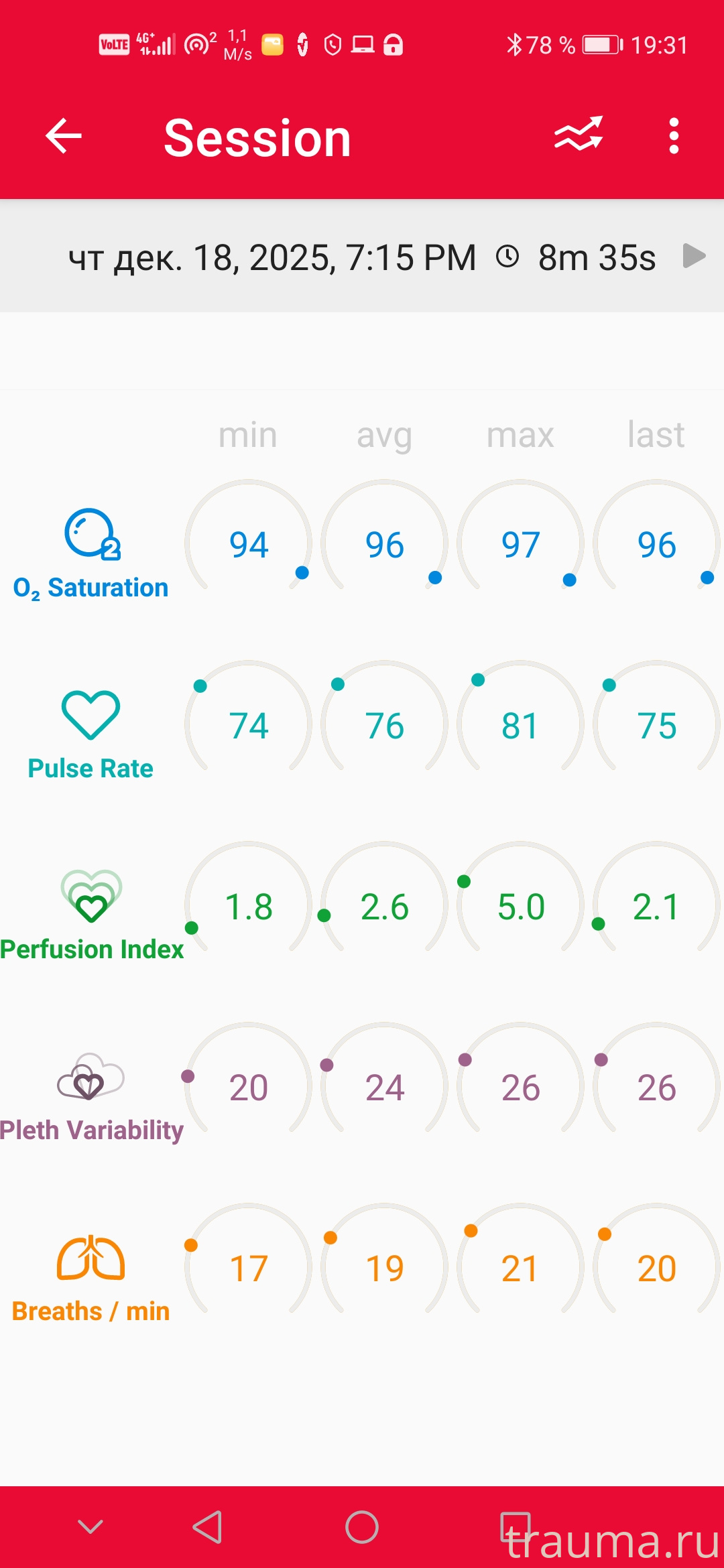 Рентген на дому: по вашему адресу приезжает врач-рентгенолог, травматолог-ортопед с мобильным рентгеновским аппаратом, проводит диагностику травмы или заболевания, делает необходимые рентгенограммы, дает рекомендации по дальнейшему лечению. Получить качественные снимки в домашних условиях возможно благодаря уникальной методике, разработанной МосРентген Центром для института  Склифосовского