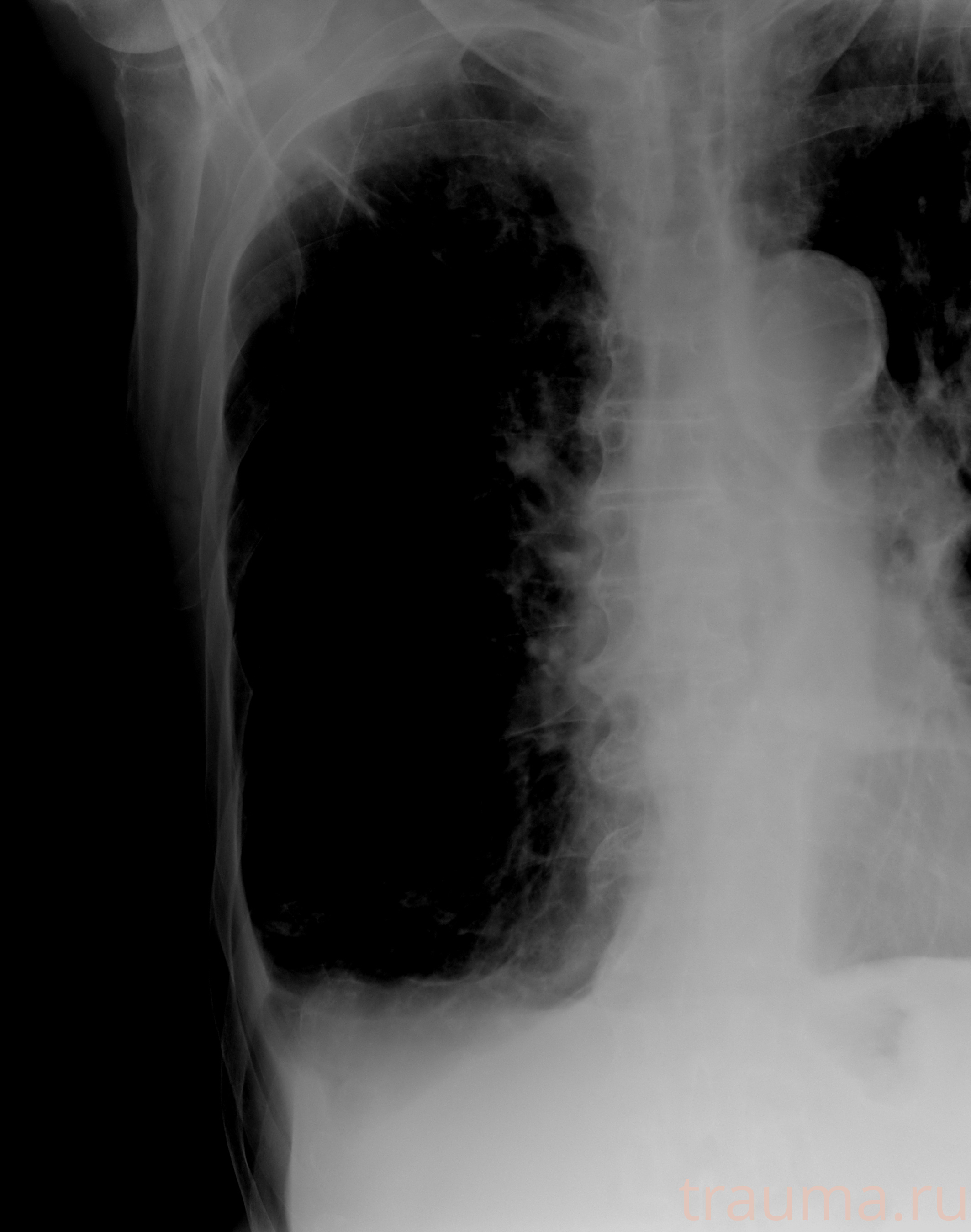 Рентген на дому: по вашему адресу приезжает врач-рентгенолог, травматолог-ортопед с мобильным рентгеновским аппаратом, проводит диагностику травмы или заболевания, делает необходимые рентгенограммы, дает рекомендации по дальнейшему лечению. Получить качественные снимки в домашних условиях возможно благодаря уникальной методике, разработанной МосРентген Центром для института  Склифосовского