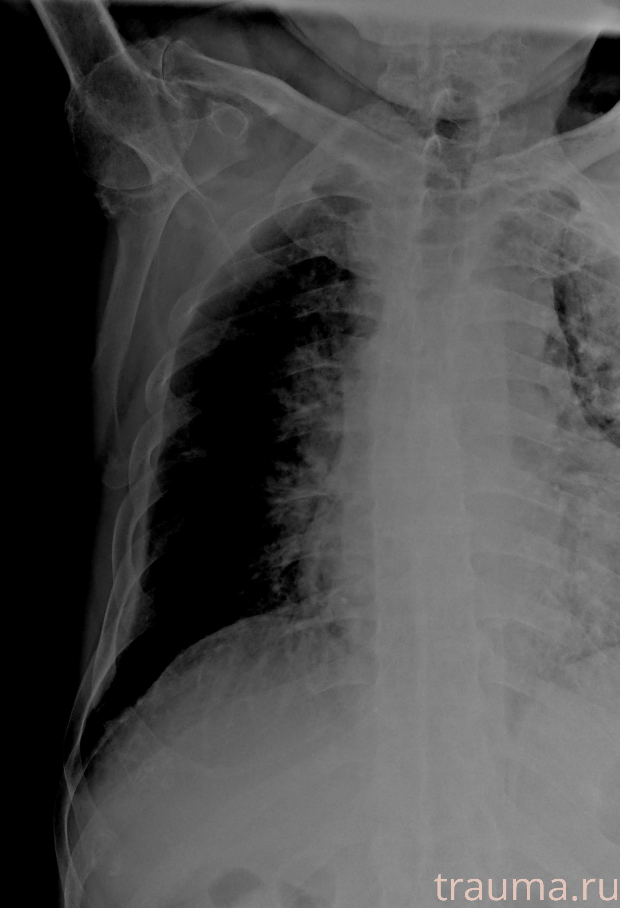 Рентген на дому: по вашему адресу приезжает врач-рентгенолог, травматолог-ортопед с мобильным рентгеновским аппаратом, проводит диагностику травмы или заболевания, делает необходимые рентгенограммы, дает рекомендации по дальнейшему лечению. Получить качественные снимки в домашних условиях возможно благодаря уникальной методике, разработанной МосРентген Центром для института  Склифосовского