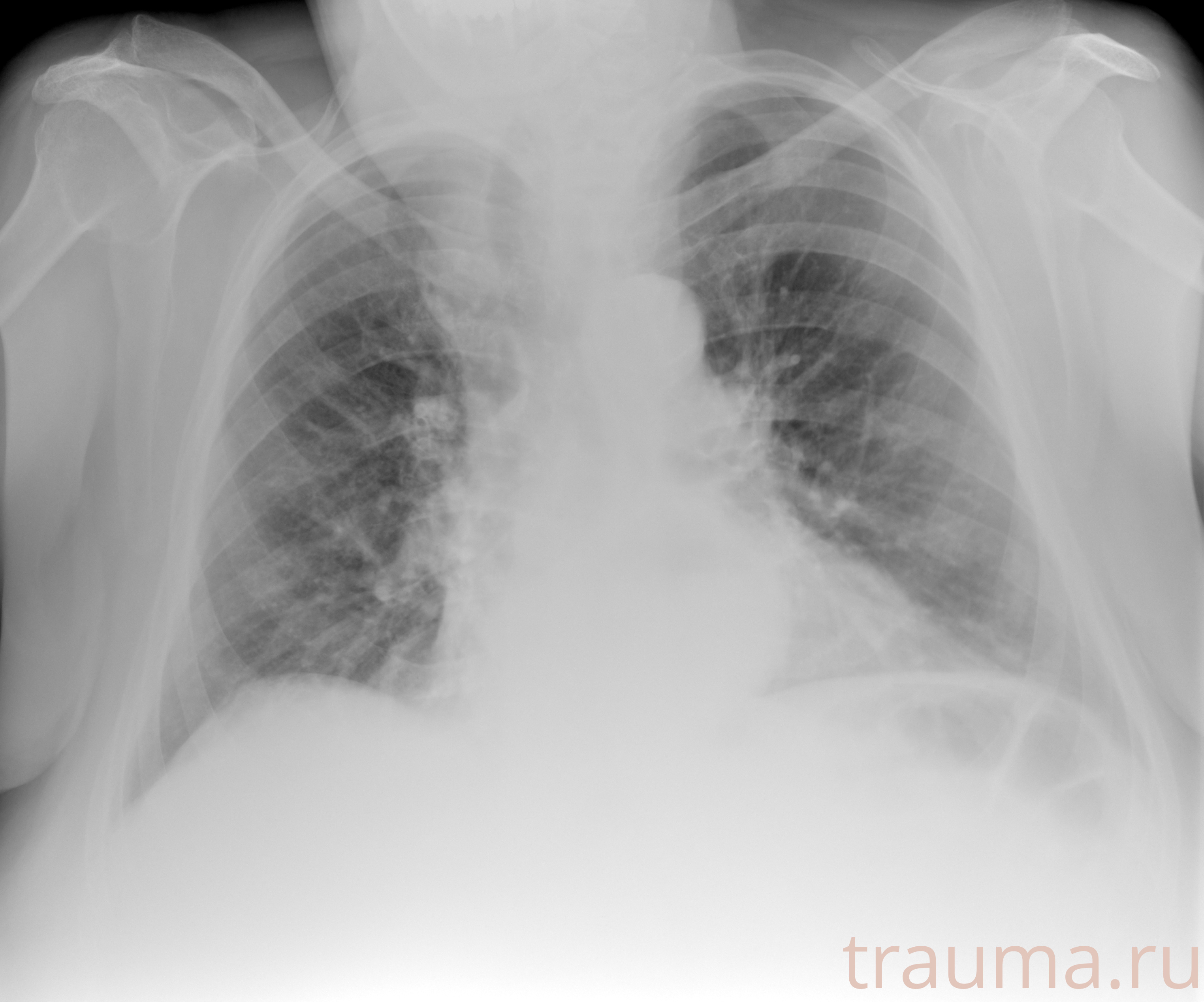 Рентген на дому: по вашему адресу приезжает врач-рентгенолог, травматолог-ортопед с мобильным рентгеновским аппаратом, проводит диагностику травмы или заболевания, делает необходимые рентгенограммы, дает рекомендации по дальнейшему лечению. Получить качественные снимки в домашних условиях возможно благодаря уникальной методике, разработанной МосРентген Центром для института  Склифосовского