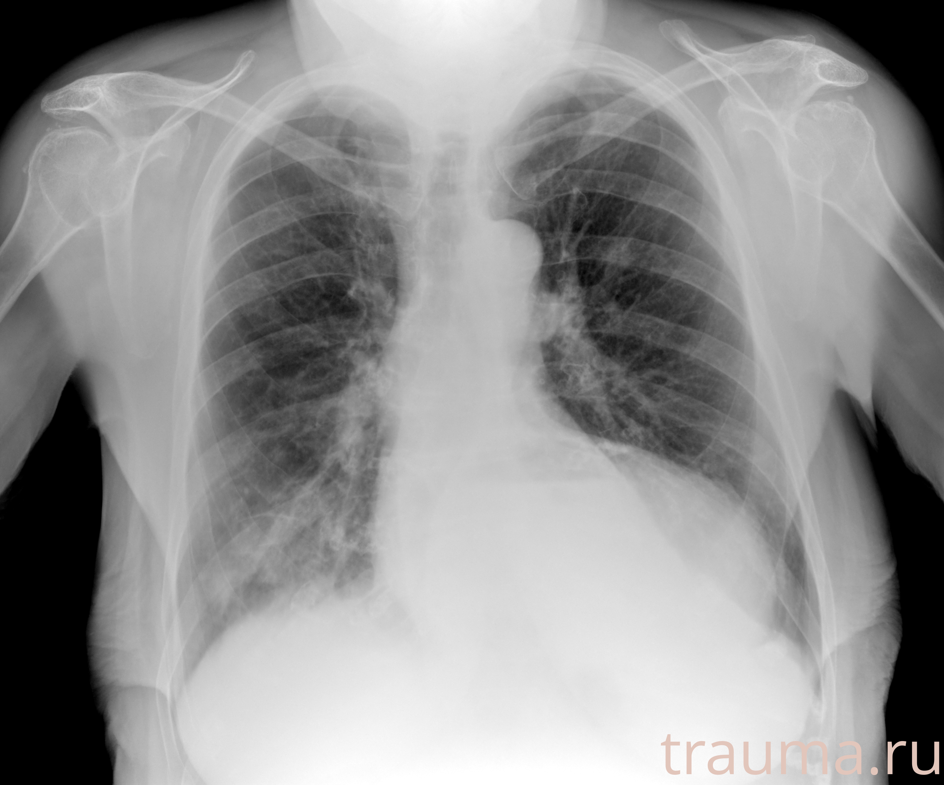 Рентген на дому: по вашему адресу приезжает врач-рентгенолог, травматолог-ортопед с мобильным рентгеновским аппаратом, проводит диагностику травмы или заболевания, делает необходимые рентгенограммы, дает рекомендации по дальнейшему лечению. Получить качественные снимки в домашних условиях возможно благодаря уникальной методике, разработанной МосРентген Центром для института  Склифосовского