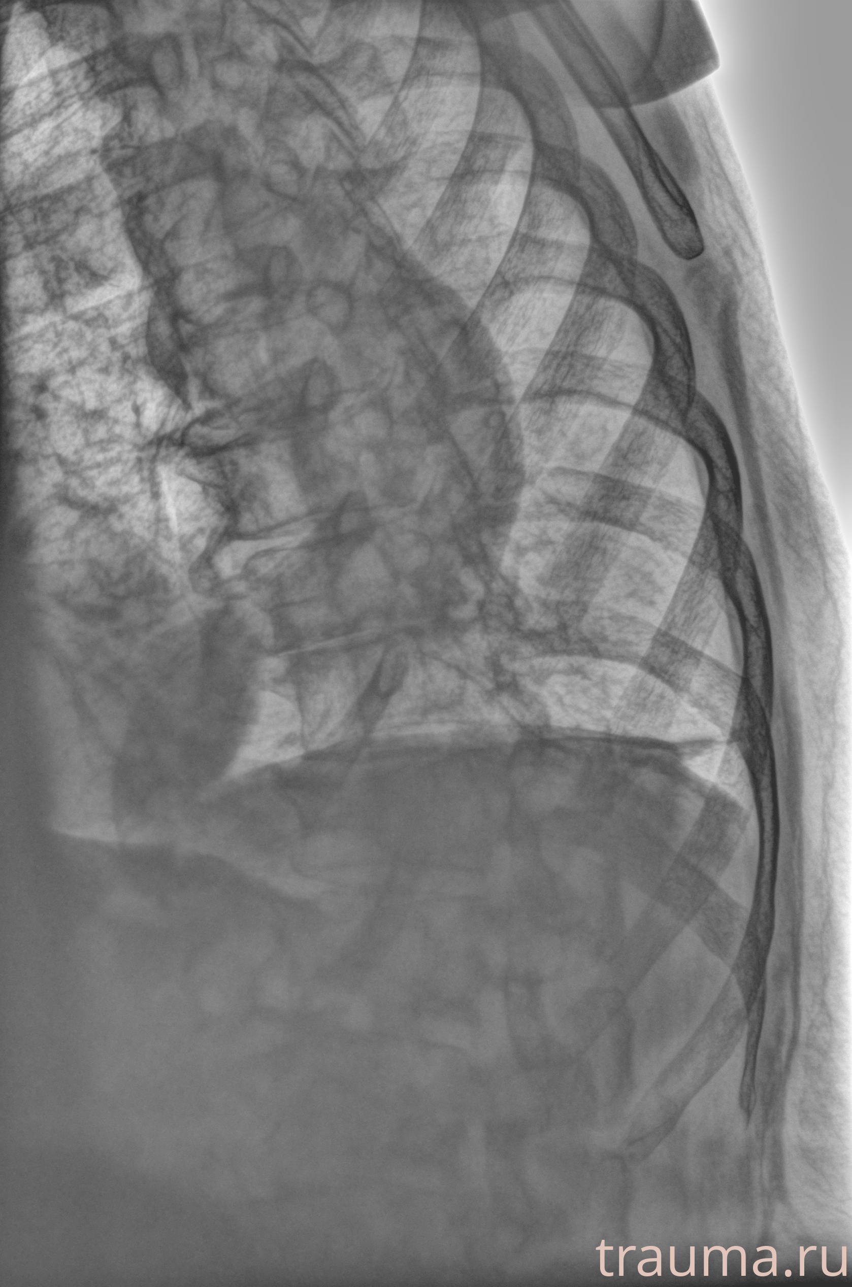 Рентген на дому: по вашему адресу приезжает врач-рентгенолог, травматолог-ортопед с мобильным рентгеновским аппаратом, проводит диагностику травмы или заболевания, делает необходимые рентгенограммы, дает рекомендации по дальнейшему лечению. Получить качественные снимки в домашних условиях возможно благодаря уникальной методике, разработанной МосРентген Центром для института  Склифосовского