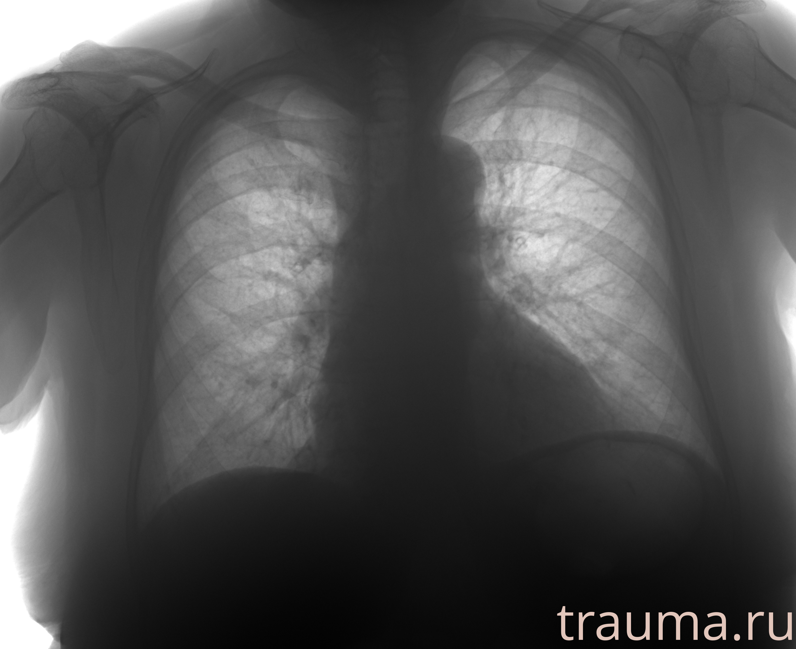 Рентген на дому: по вашему адресу приезжает врач-рентгенолог, травматолог-ортопед с мобильным рентгеновским аппаратом, проводит диагностику травмы или заболевания, делает необходимые рентгенограммы, дает рекомендации по дальнейшему лечению. Получить качественные снимки в домашних условиях возможно благодаря уникальной методике, разработанной МосРентген Центром для института  Склифосовского