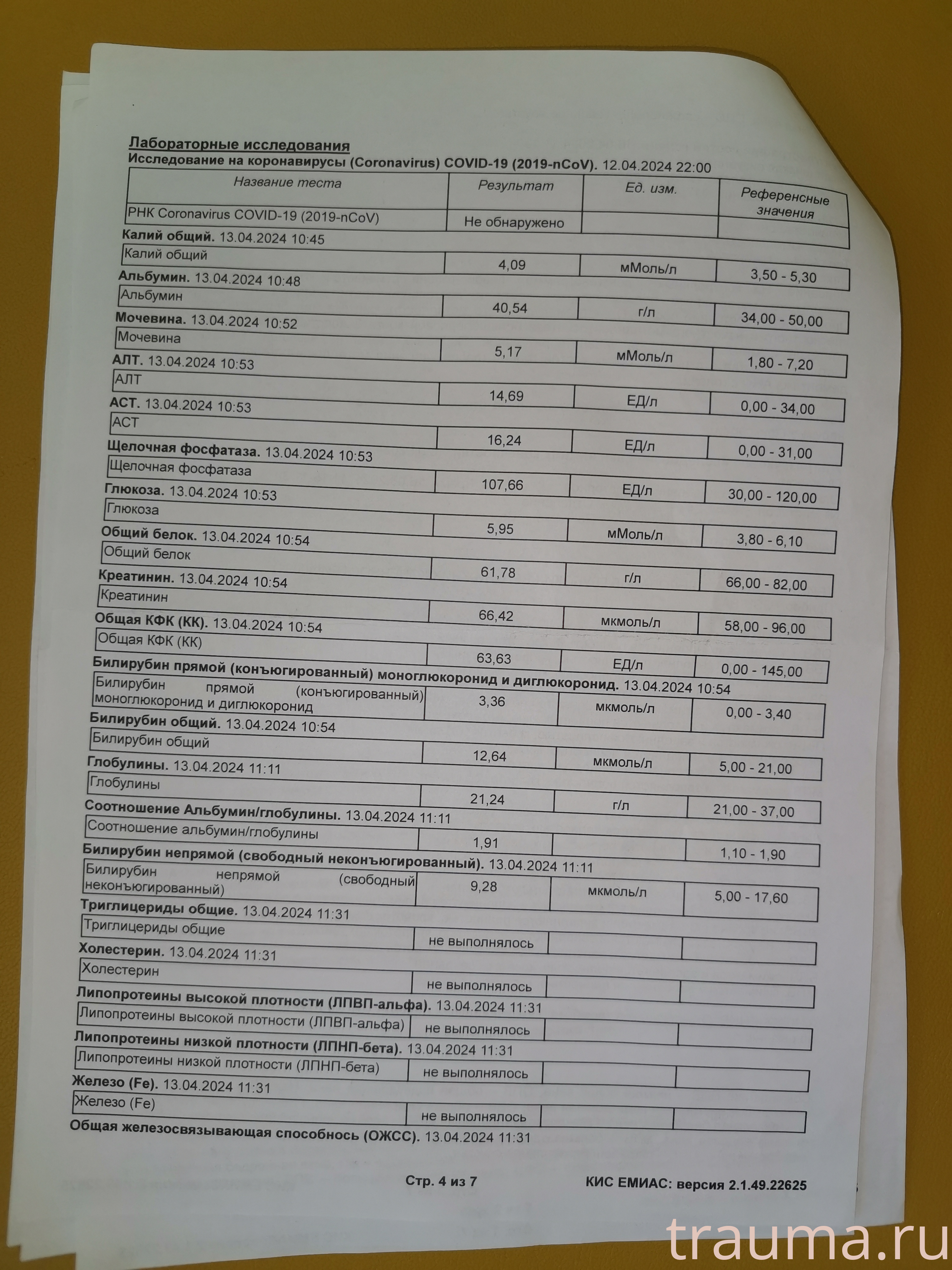 Рентген на дому: по вашему адресу приезжает врач-рентгенолог, травматолог-ортопед с мобильным рентгеновским аппаратом, проводит диагностику травмы или заболевания, делает необходимые рентгенограммы, дает рекомендации по дальнейшему лечению. Получить качественные снимки в домашних условиях возможно благодаря уникальной методике, разработанной МосРентген Центром для института  Склифосовского