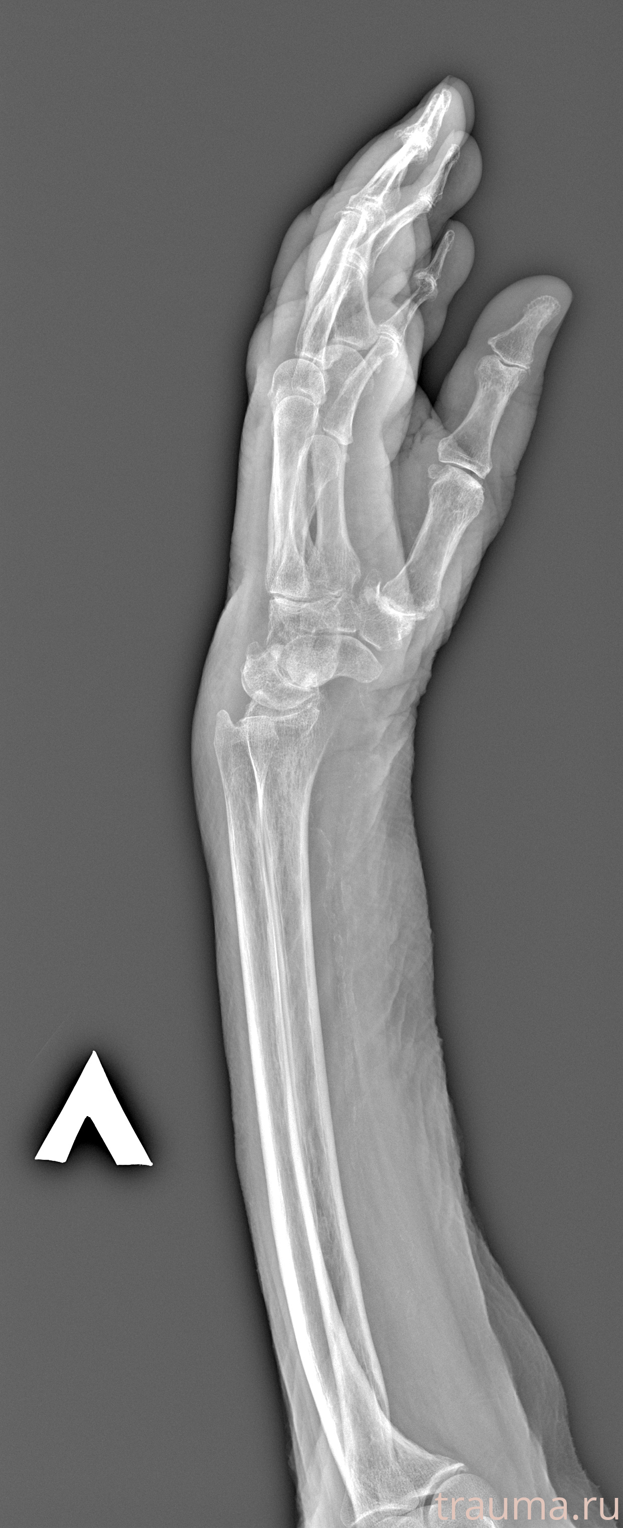 Рентген на дому: по вашему адресу приезжает врач-рентгенолог, травматолог-ортопед с мобильным рентгеновским аппаратом, проводит диагностику травмы или заболевания, делает необходимые рентгенограммы, дает рекомендации по дальнейшему лечению. Получить качественные снимки в домашних условиях возможно благодаря уникальной методике, разработанной МосРентген Центром для института  Склифосовского