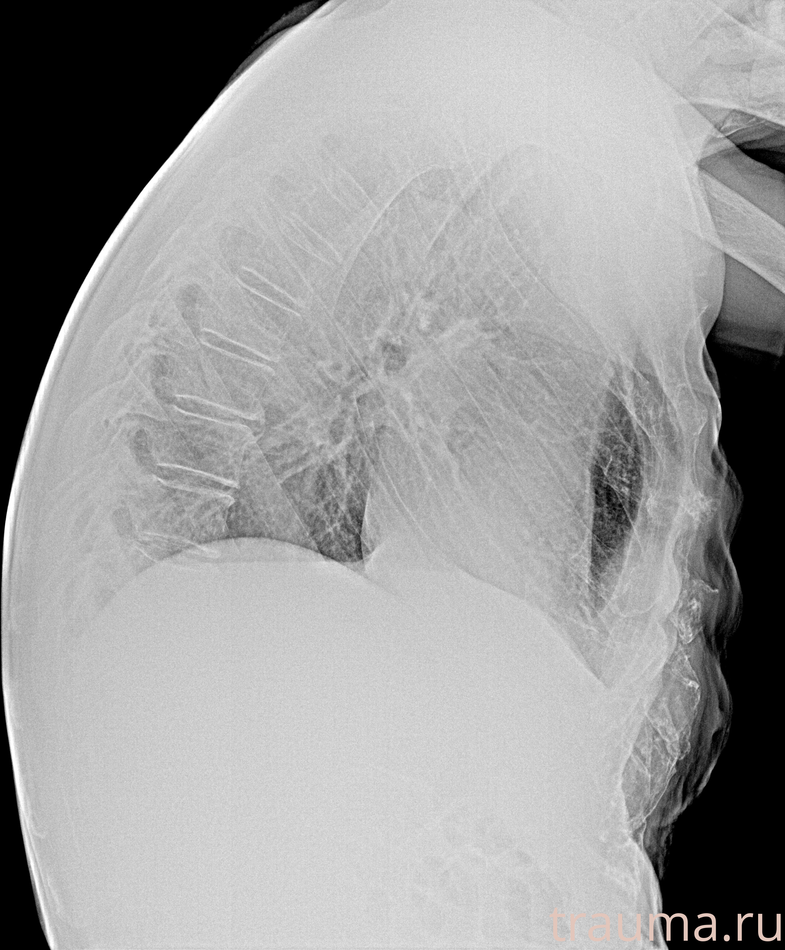 Рентген на дому: по вашему адресу приезжает врач-рентгенолог, травматолог-ортопед с мобильным рентгеновским аппаратом, проводит диагностику травмы или заболевания, делает необходимые рентгенограммы, дает рекомендации по дальнейшему лечению. Получить качественные снимки в домашних условиях возможно благодаря уникальной методике, разработанной МосРентген Центром для института  Склифосовского