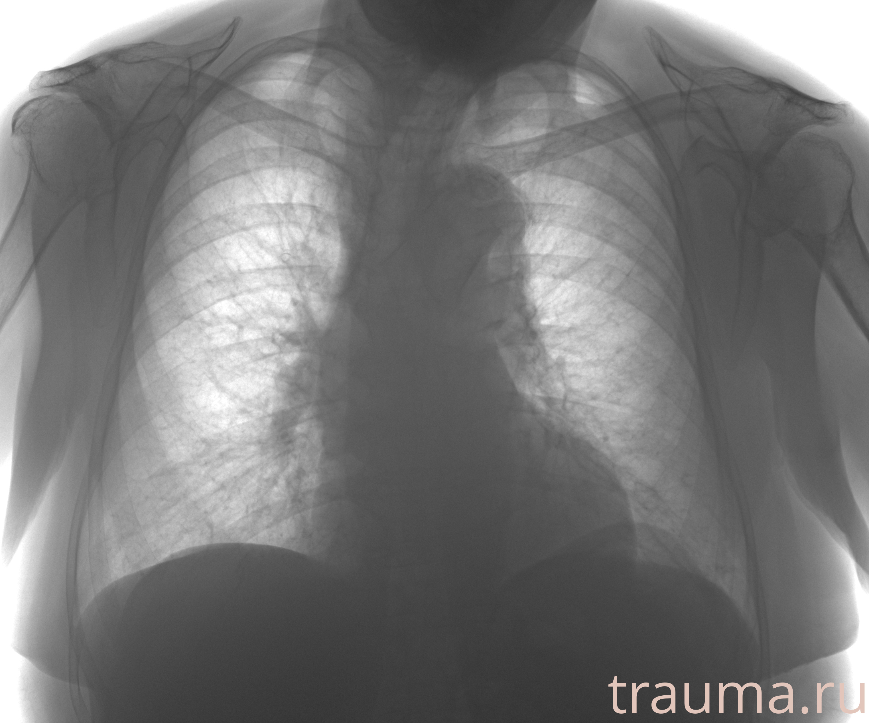 Рентген на дому: по вашему адресу приезжает врач-рентгенолог, травматолог-ортопед с мобильным рентгеновским аппаратом, проводит диагностику травмы или заболевания, делает необходимые рентгенограммы, дает рекомендации по дальнейшему лечению. Получить качественные снимки в домашних условиях возможно благодаря уникальной методике, разработанной МосРентген Центром для института  Склифосовского