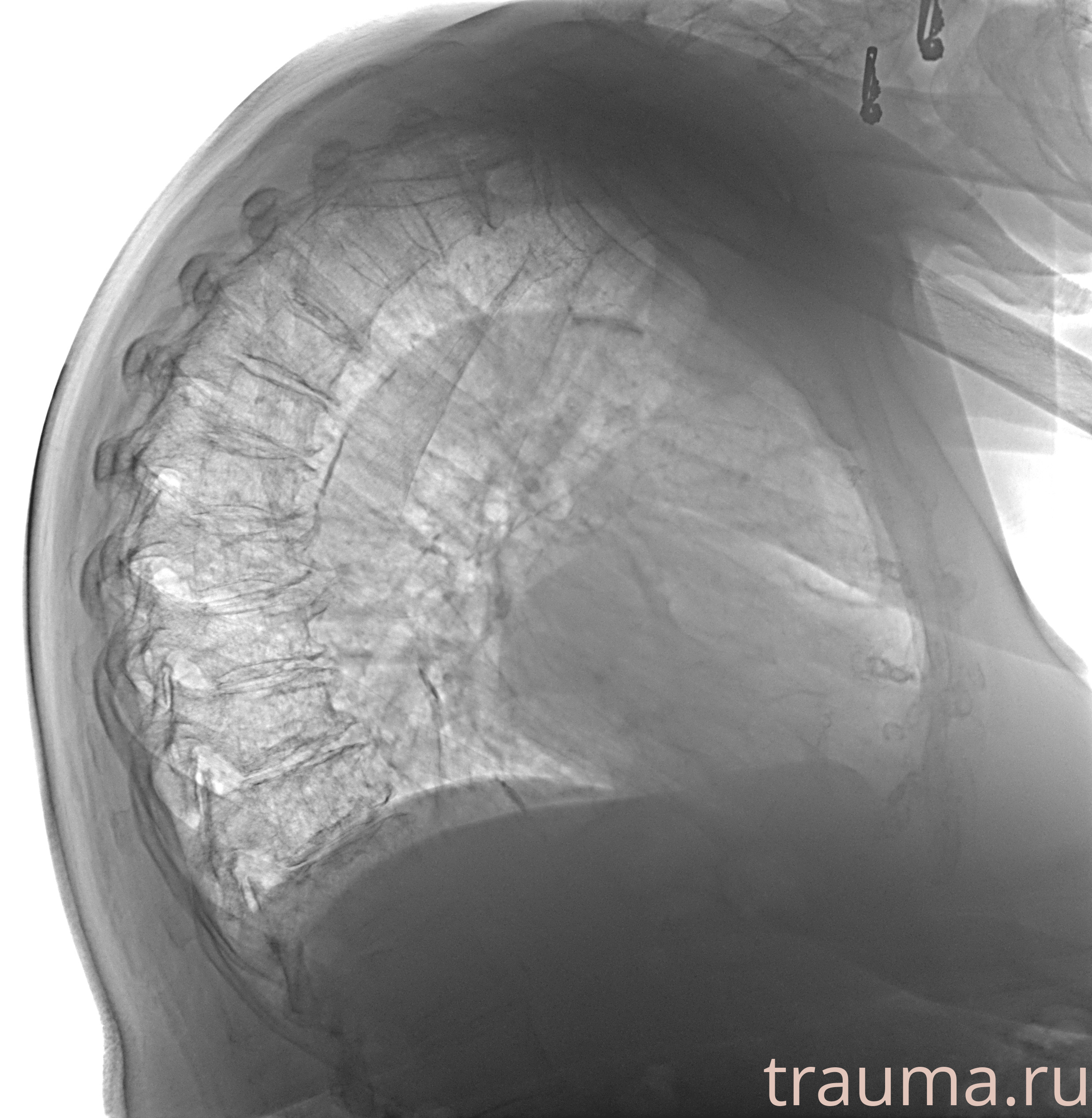 Рентген на дому: по вашему адресу приезжает врач-рентгенолог, травматолог-ортопед с мобильным рентгеновским аппаратом, проводит диагностику травмы или заболевания, делает необходимые рентгенограммы, дает рекомендации по дальнейшему лечению. Получить качественные снимки в домашних условиях возможно благодаря уникальной методике, разработанной МосРентген Центром для института  Склифосовского