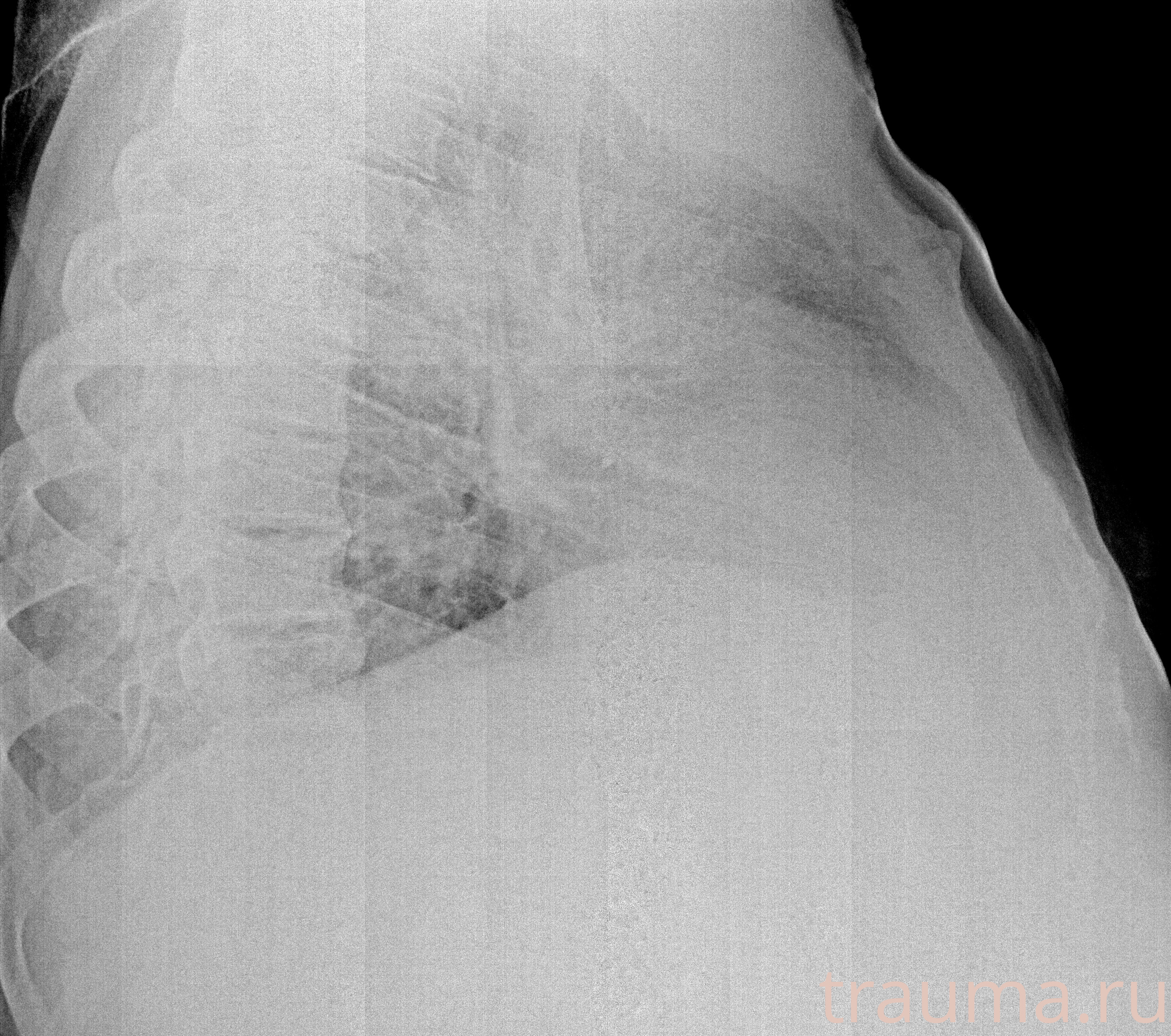 Рентген на дому: по вашему адресу приезжает врач-рентгенолог, травматолог-ортопед с мобильным рентгеновским аппаратом, проводит диагностику травмы или заболевания, делает необходимые рентгенограммы, дает рекомендации по дальнейшему лечению. Получить качественные снимки в домашних условиях возможно благодаря уникальной методике, разработанной МосРентген Центром для института  Склифосовского