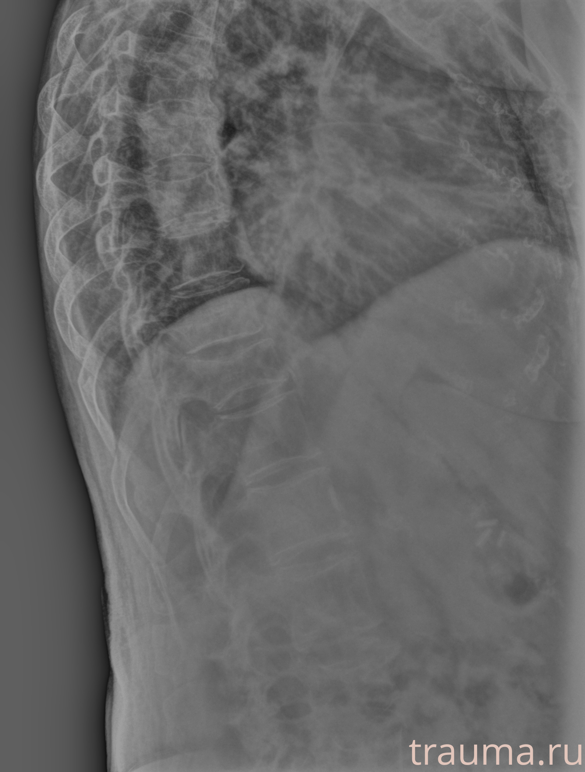 Рентген на дому: по вашему адресу приезжает врач-рентгенолог, травматолог-ортопед с мобильным рентгеновским аппаратом, проводит диагностику травмы или заболевания, делает необходимые рентгенограммы, дает рекомендации по дальнейшему лечению. Получить качественные снимки в домашних условиях возможно благодаря уникальной методике, разработанной МосРентген Центром для института  Склифосовского