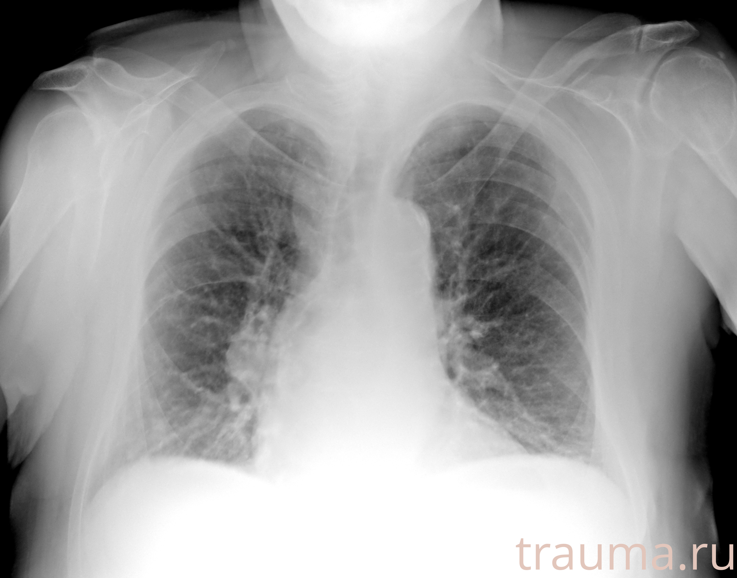 Рентген на дому: по вашему адресу приезжает врач-рентгенолог, травматолог-ортопед с мобильным рентгеновским аппаратом, проводит диагностику травмы или заболевания, делает необходимые рентгенограммы, дает рекомендации по дальнейшему лечению. Получить качественные снимки в домашних условиях возможно благодаря уникальной методике, разработанной МосРентген Центром для института  Склифосовского