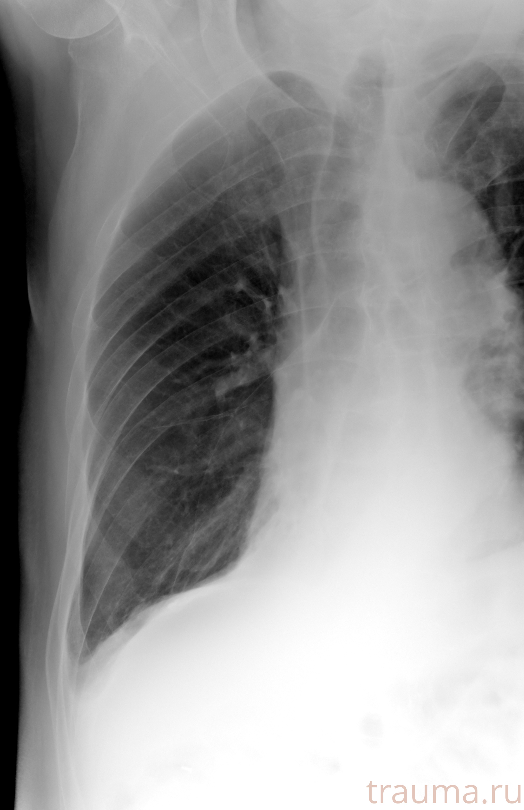 Рентген на дому: по вашему адресу приезжает врач-рентгенолог, травматолог-ортопед с мобильным рентгеновским аппаратом, проводит диагностику травмы или заболевания, делает необходимые рентгенограммы, дает рекомендации по дальнейшему лечению. Получить качественные снимки в домашних условиях возможно благодаря уникальной методике, разработанной МосРентген Центром для института  Склифосовского