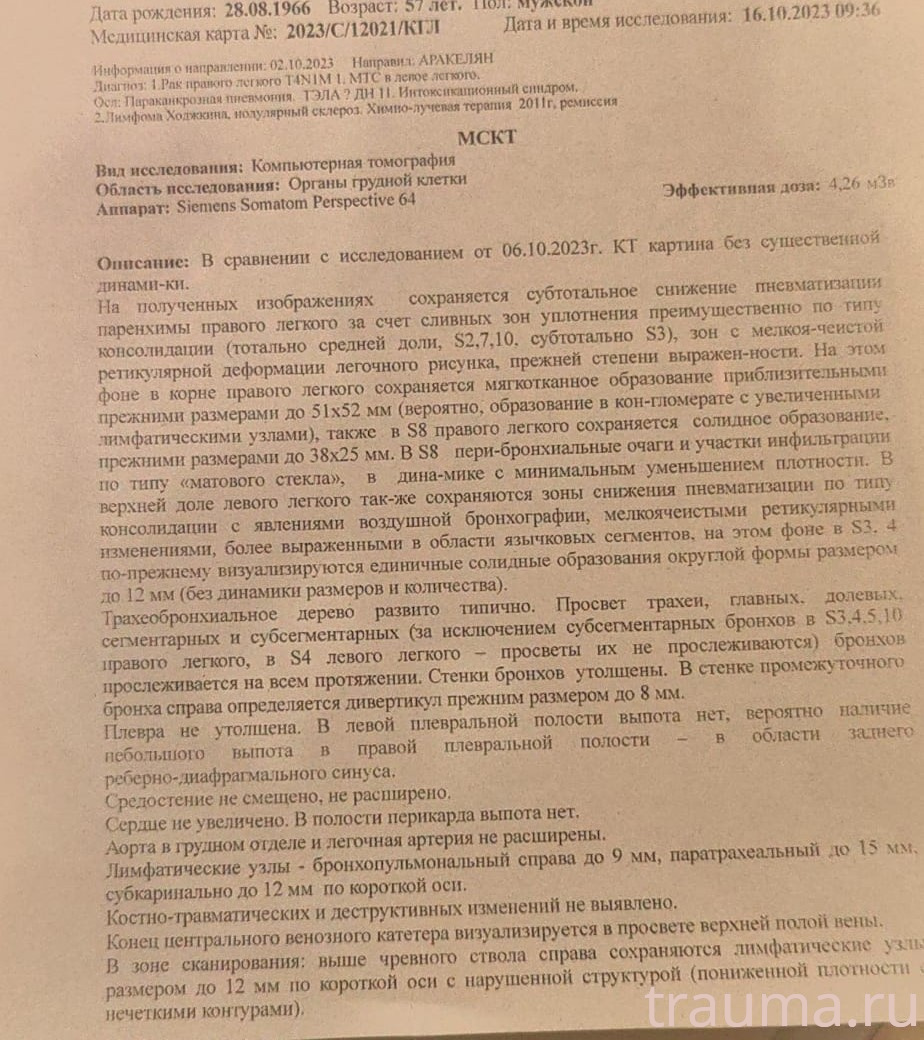 Рентген на дому: по вашему адресу приезжает врач-рентгенолог, травматолог-ортопед с мобильным рентгеновским аппаратом, проводит диагностику травмы или заболевания, делает необходимые рентгенограммы, дает рекомендации по дальнейшему лечению. Получить качественные снимки в домашних условиях возможно благодаря уникальной методике, разработанной МосРентген Центром для института  Склифосовского