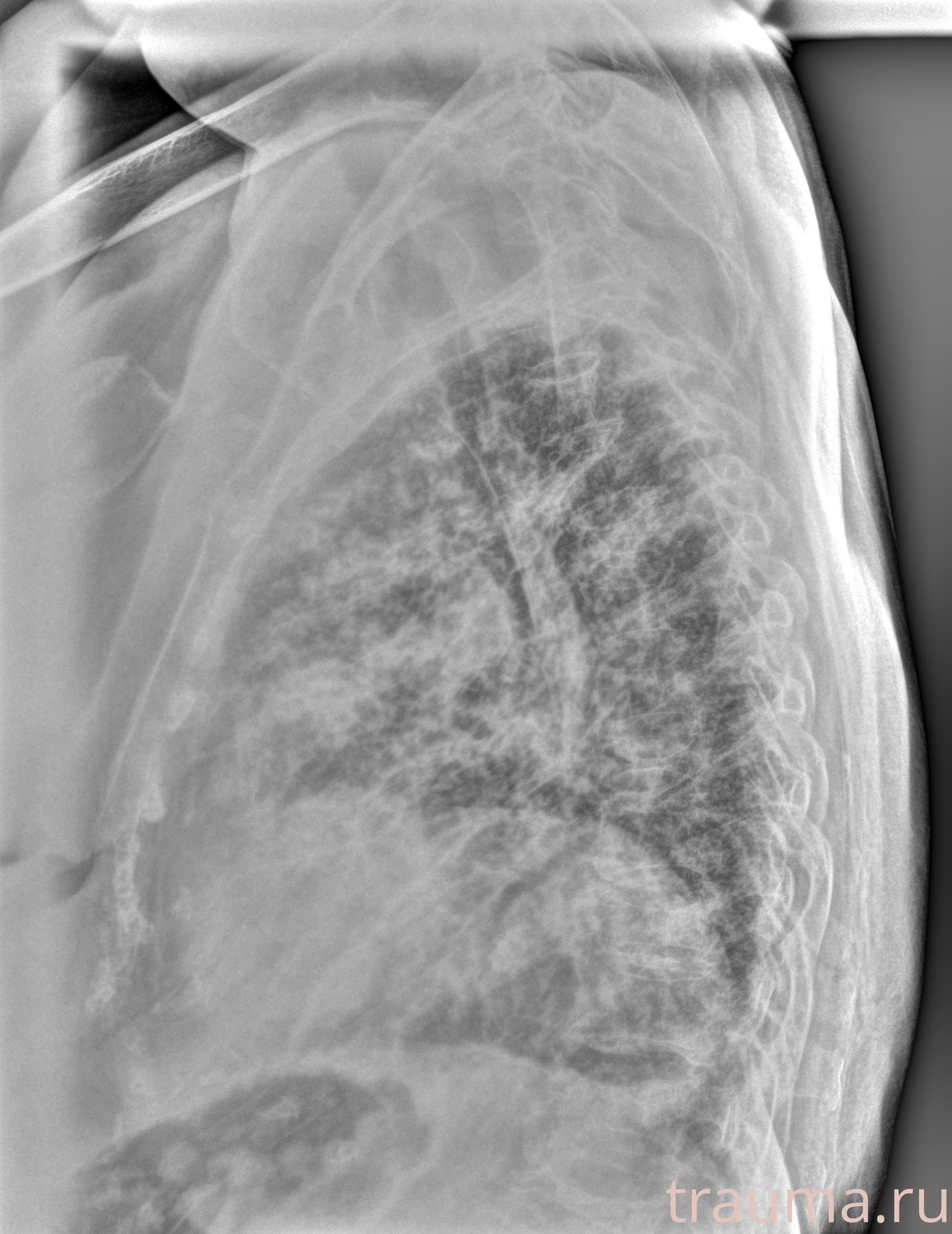 Рентген на дому: по вашему адресу приезжает врач-рентгенолог, травматолог-ортопед с мобильным рентгеновским аппаратом, проводит диагностику травмы или заболевания, делает необходимые рентгенограммы, дает рекомендации по дальнейшему лечению. Получить качественные снимки в домашних условиях возможно благодаря уникальной методике, разработанной МосРентген Центром для института  Склифосовского