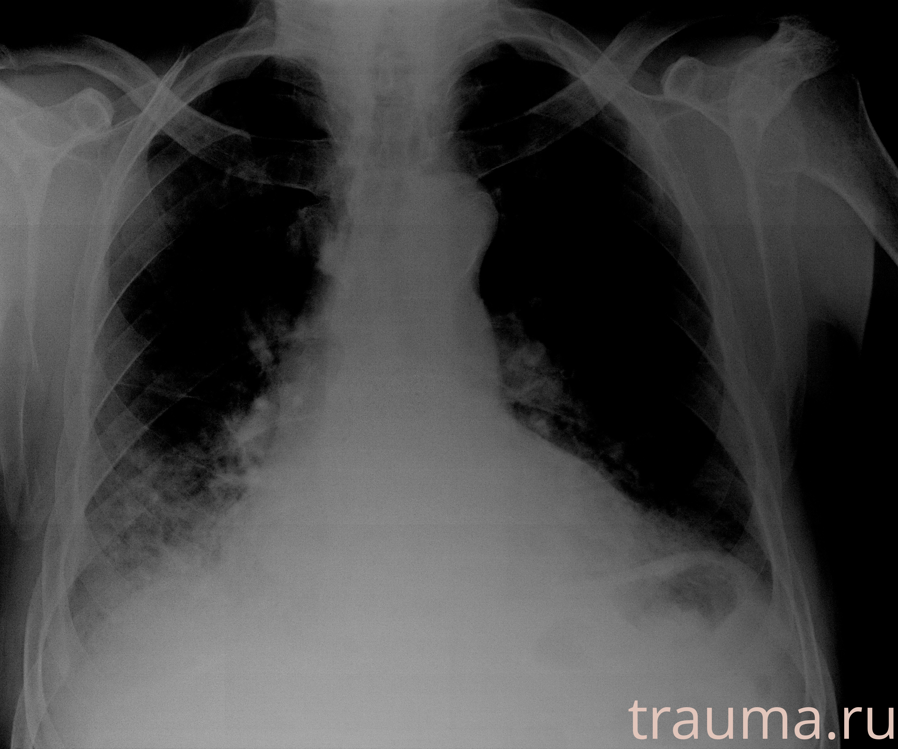 Рентген на дому: по вашему адресу приезжает врач-рентгенолог, травматолог-ортопед с мобильным рентгеновским аппаратом, проводит диагностику травмы или заболевания, делает необходимые рентгенограммы, дает рекомендации по дальнейшему лечению. Получить качественные снимки в домашних условиях возможно благодаря уникальной методике, разработанной МосРентген Центром для института  Склифосовского