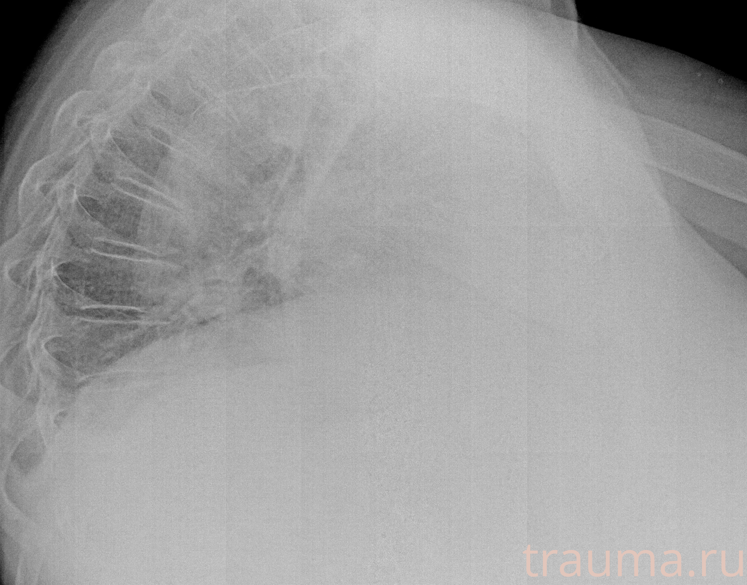 Рентген на дому: по вашему адресу приезжает врач-рентгенолог, травматолог-ортопед с мобильным рентгеновским аппаратом, проводит диагностику травмы или заболевания, делает необходимые рентгенограммы, дает рекомендации по дальнейшему лечению. Получить качественные снимки в домашних условиях возможно благодаря уникальной методике, разработанной МосРентген Центром для института  Склифосовского