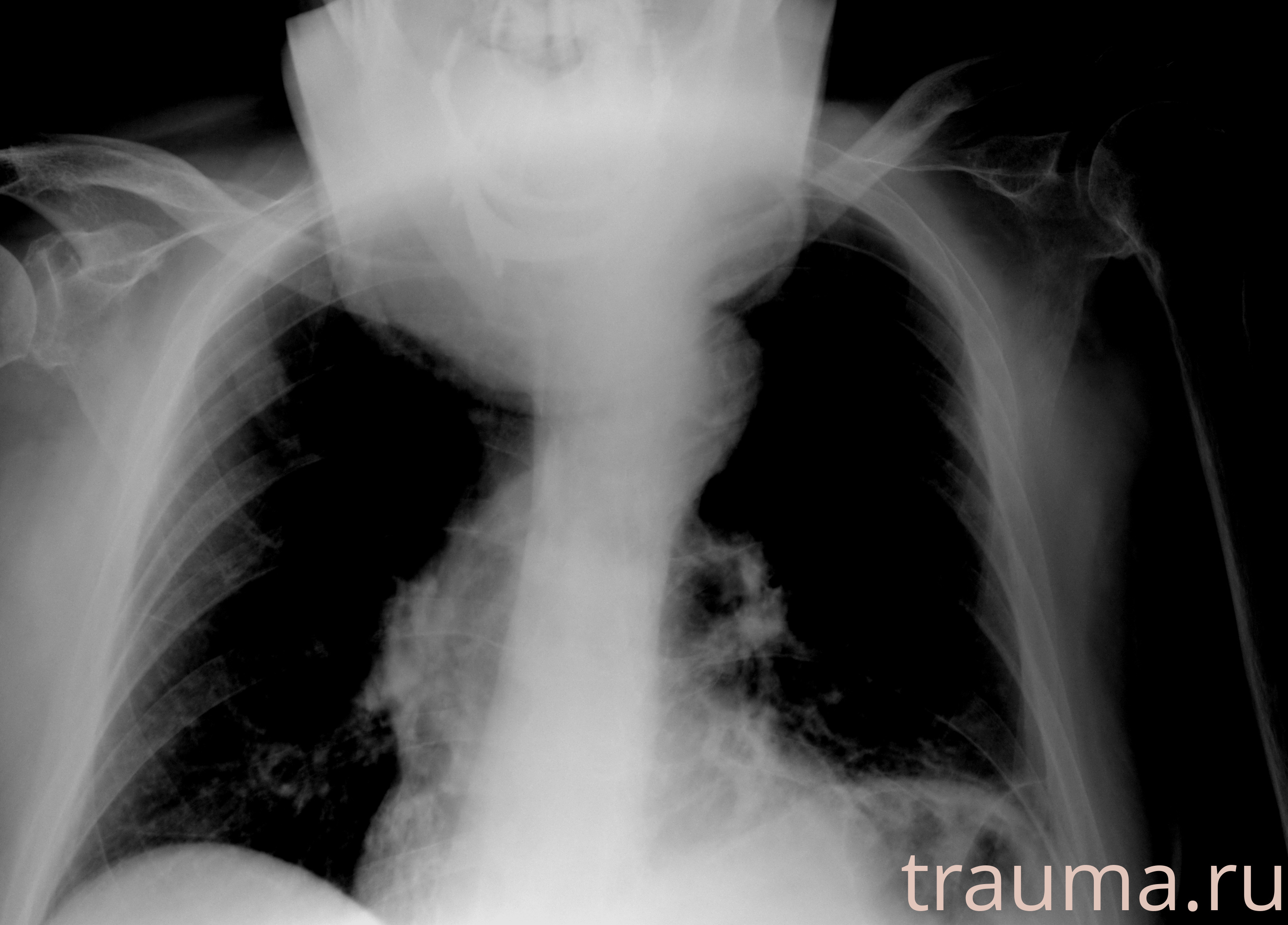 Рентген на дому: по вашему адресу приезжает врач-рентгенолог, травматолог-ортопед с мобильным рентгеновским аппаратом, проводит диагностику травмы или заболевания, делает необходимые рентгенограммы, дает рекомендации по дальнейшему лечению. Получить качественные снимки в домашних условиях возможно благодаря уникальной методике, разработанной МосРентген Центром для института  Склифосовского