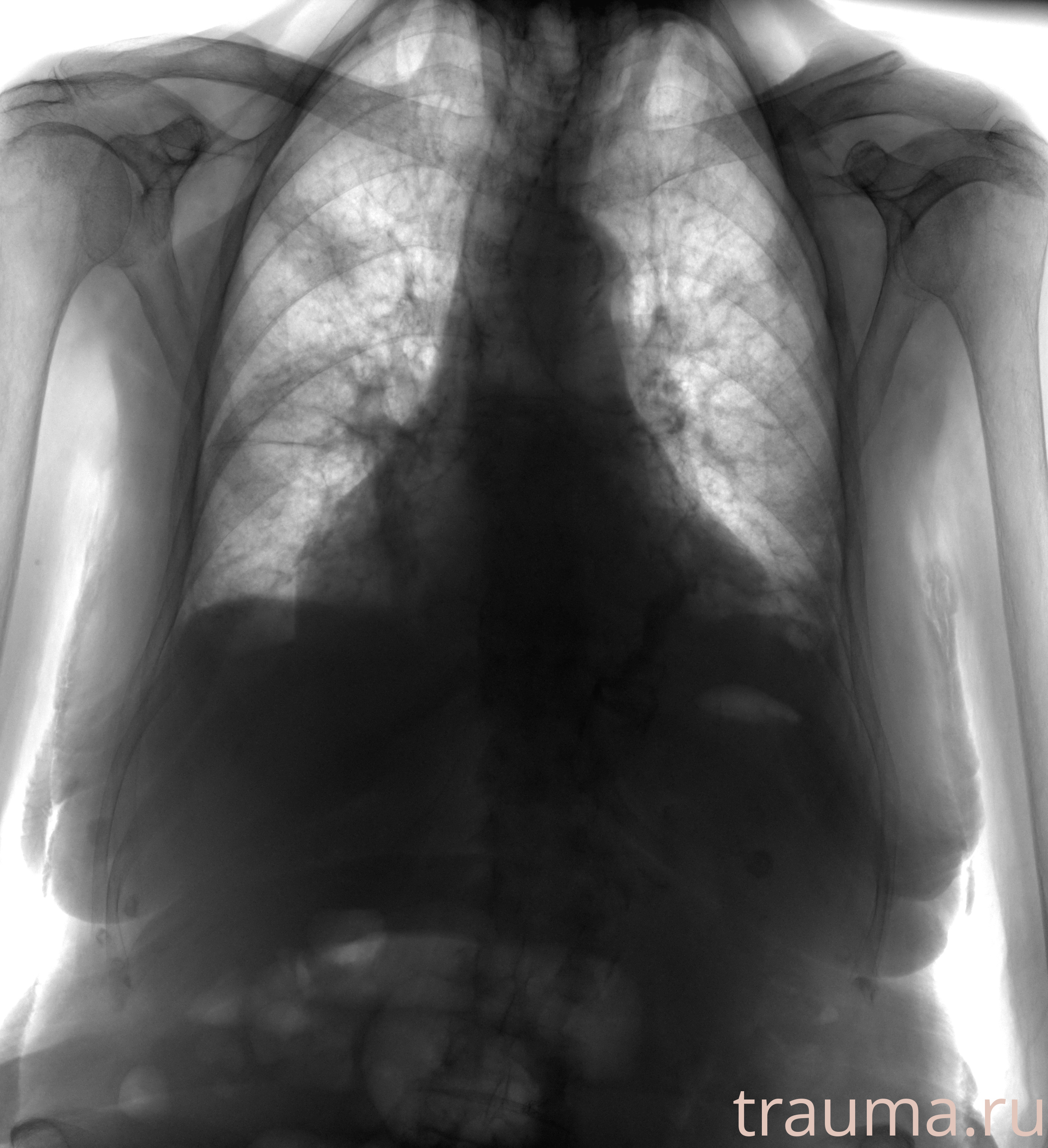 Рентген на дому: по вашему адресу приезжает врач-рентгенолог, травматолог-ортопед с мобильным рентгеновским аппаратом, проводит диагностику травмы или заболевания, делает необходимые рентгенограммы, дает рекомендации по дальнейшему лечению. Получить качественные снимки в домашних условиях возможно благодаря уникальной методике, разработанной МосРентген Центром для института  Склифосовского