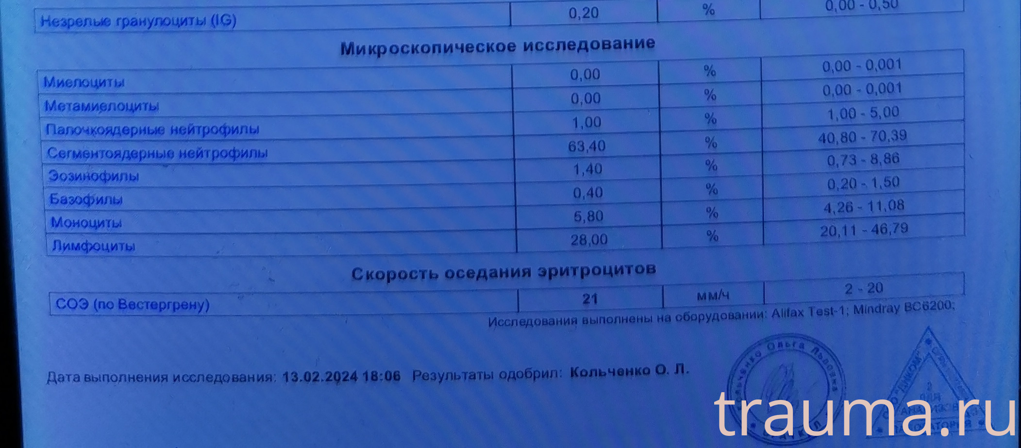 Рентген на дому: по вашему адресу приезжает врач-рентгенолог, травматолог-ортопед с мобильным рентгеновским аппаратом, проводит диагностику травмы или заболевания, делает необходимые рентгенограммы, дает рекомендации по дальнейшему лечению. Получить качественные снимки в домашних условиях возможно благодаря уникальной методике, разработанной МосРентген Центром для института  Склифосовского