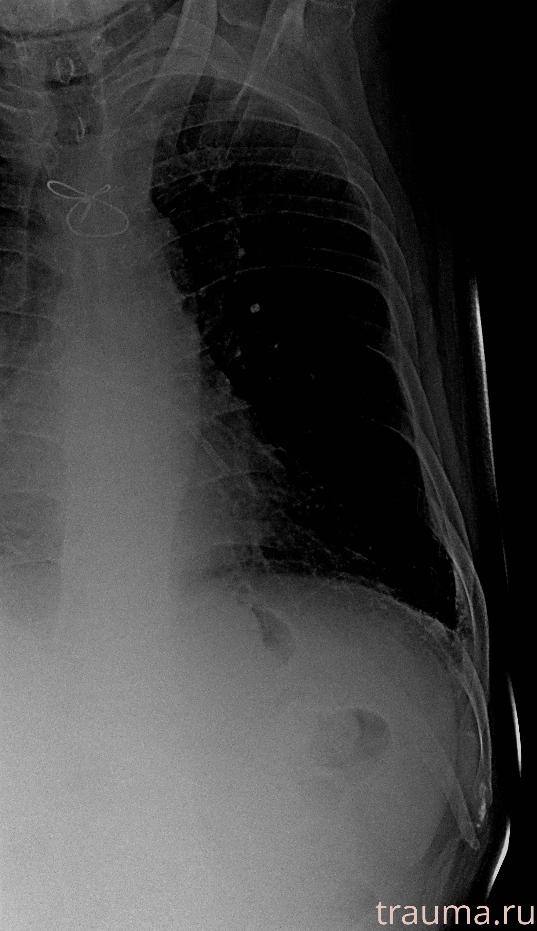 Рентген на дому: по вашему адресу приезжает врач-рентгенолог, травматолог-ортопед с мобильным рентгеновским аппаратом, проводит диагностику травмы или заболевания, делает необходимые рентгенограммы, дает рекомендации по дальнейшему лечению. Получить качественные снимки в домашних условиях возможно благодаря уникальной методике, разработанной МосРентген Центром для института  Склифосовского